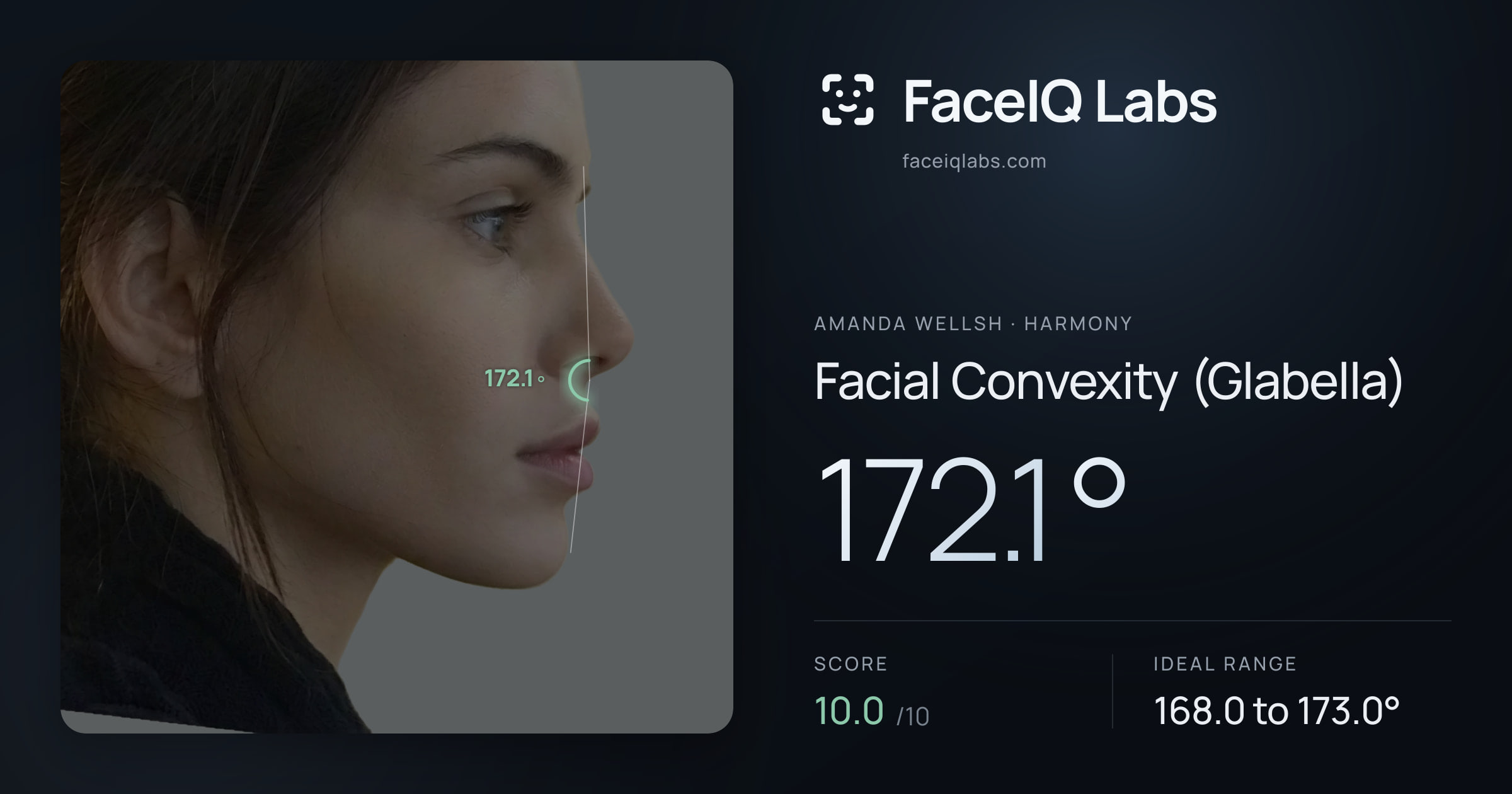 Amanda Wellsh Facial Convexity (Glabella): 172.1°, drawn on the photo