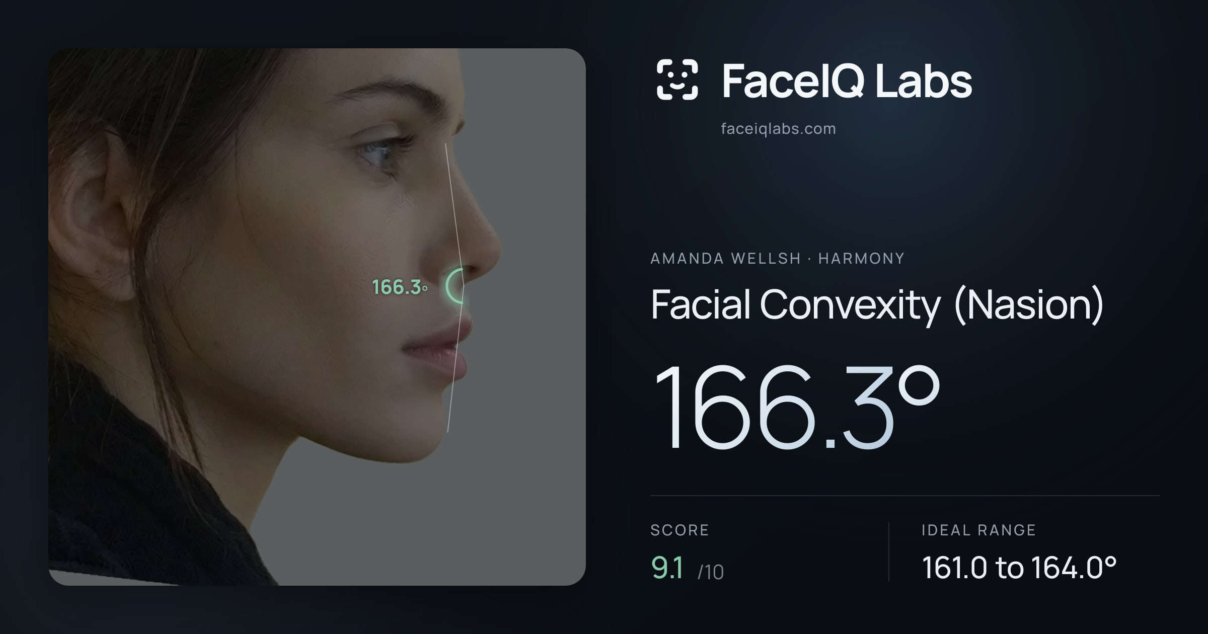 Amanda Wellsh Facial Convexity (Nasion): 166.3°, drawn on the photo