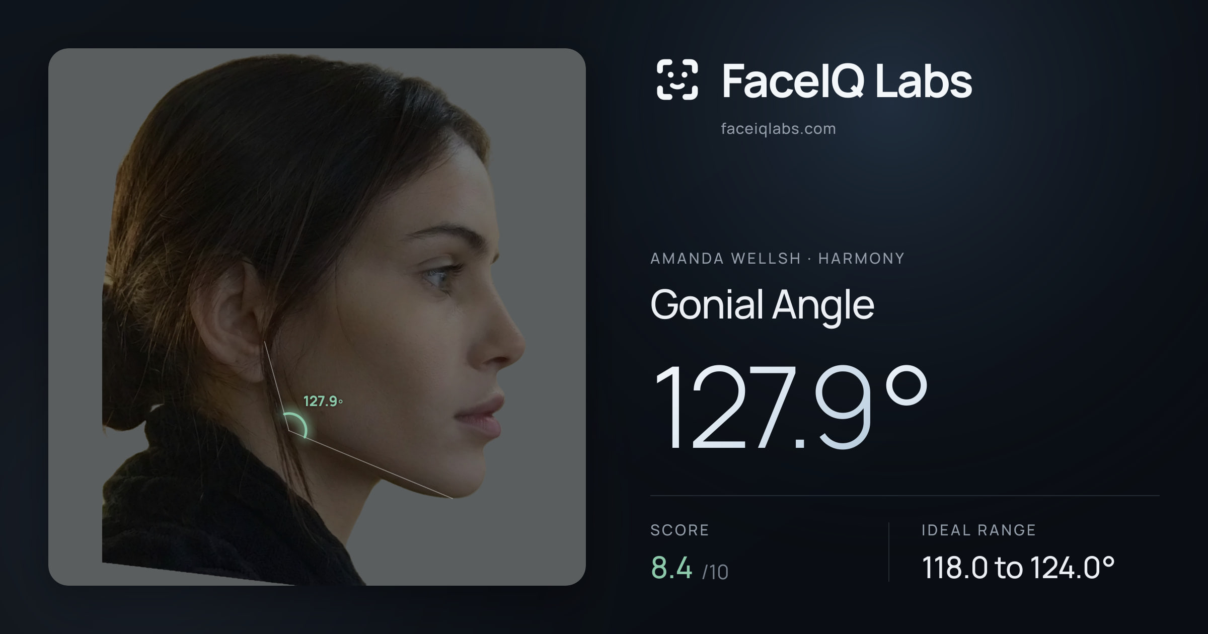 Amanda Wellsh Gonial Angle: 127.9°, drawn on the photo
