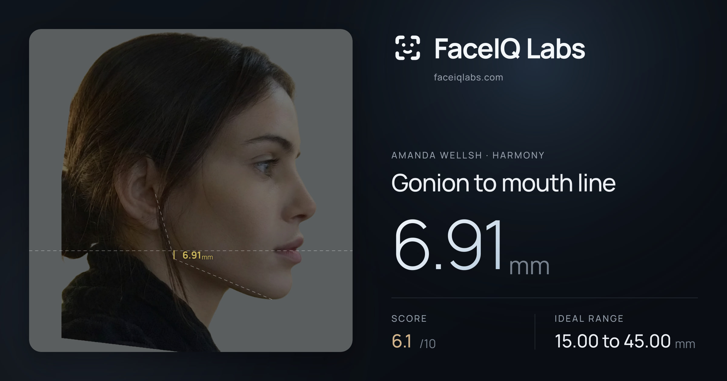 Amanda Wellsh Gonion to mouth line: 6.91mm, drawn on the photo