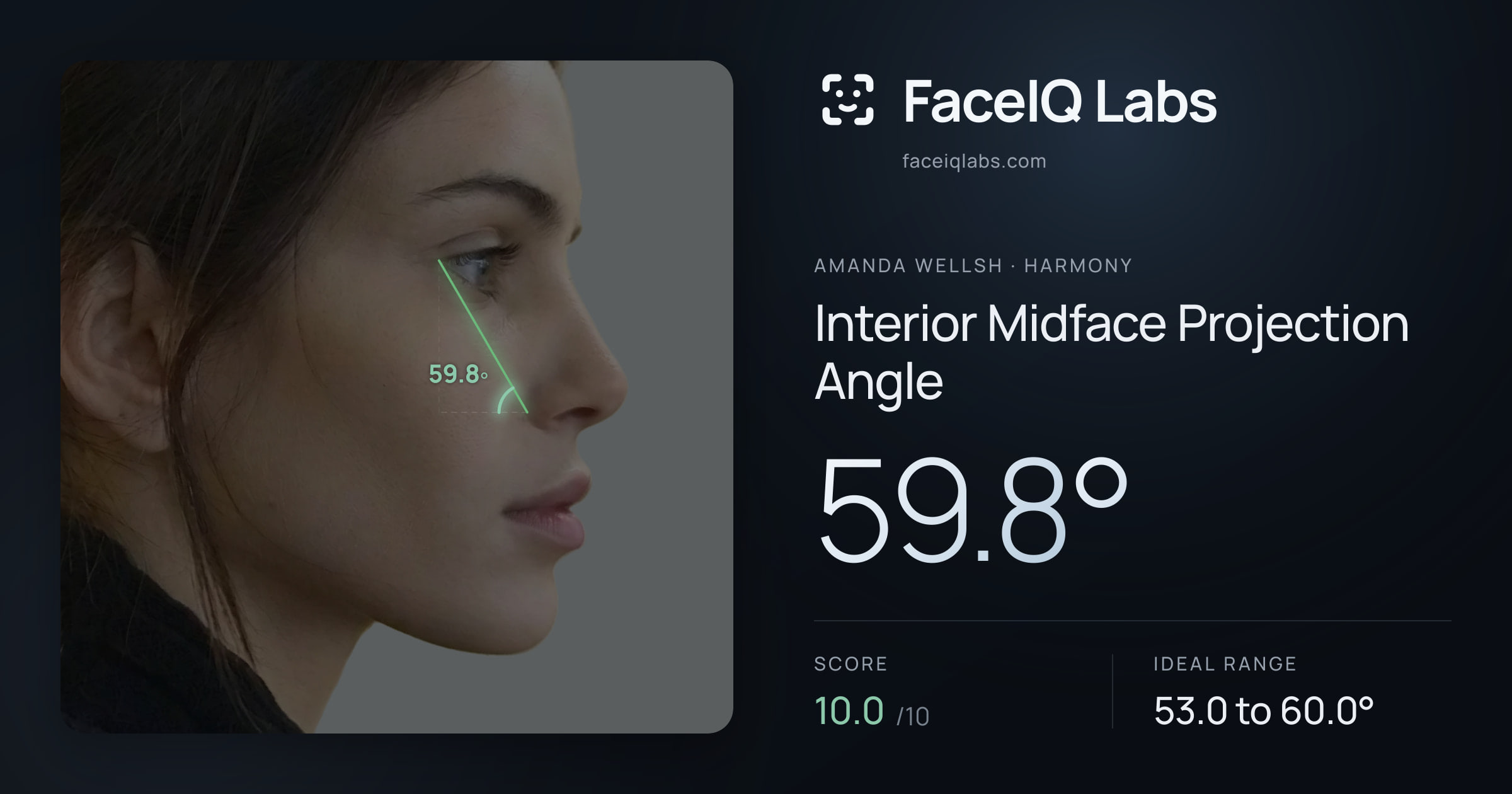 Amanda Wellsh Interior Midface Projection Angle: 59.8°, drawn on the photo