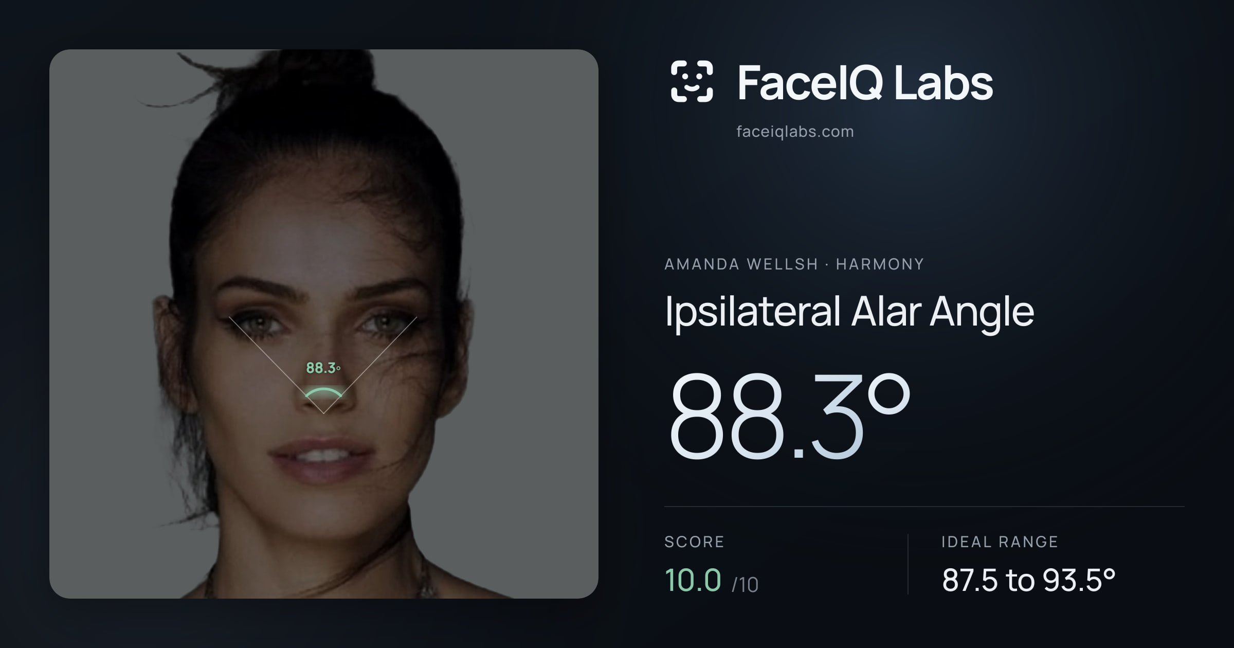 Amanda Wellsh Ipsilateral Alar Angle: 88.3°, drawn on the photo