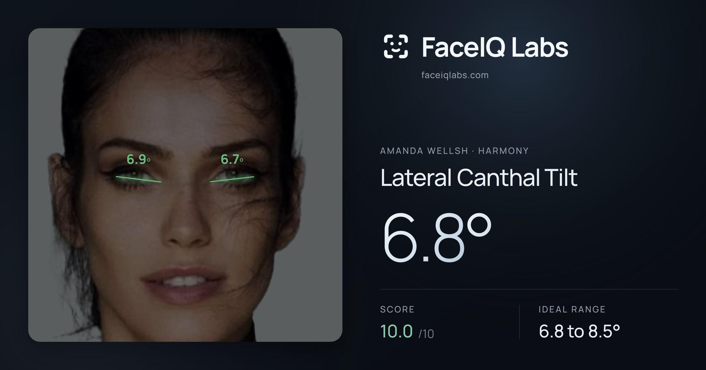 Amanda Wellsh Lateral Canthal Tilt: 6.8°, drawn on the photo