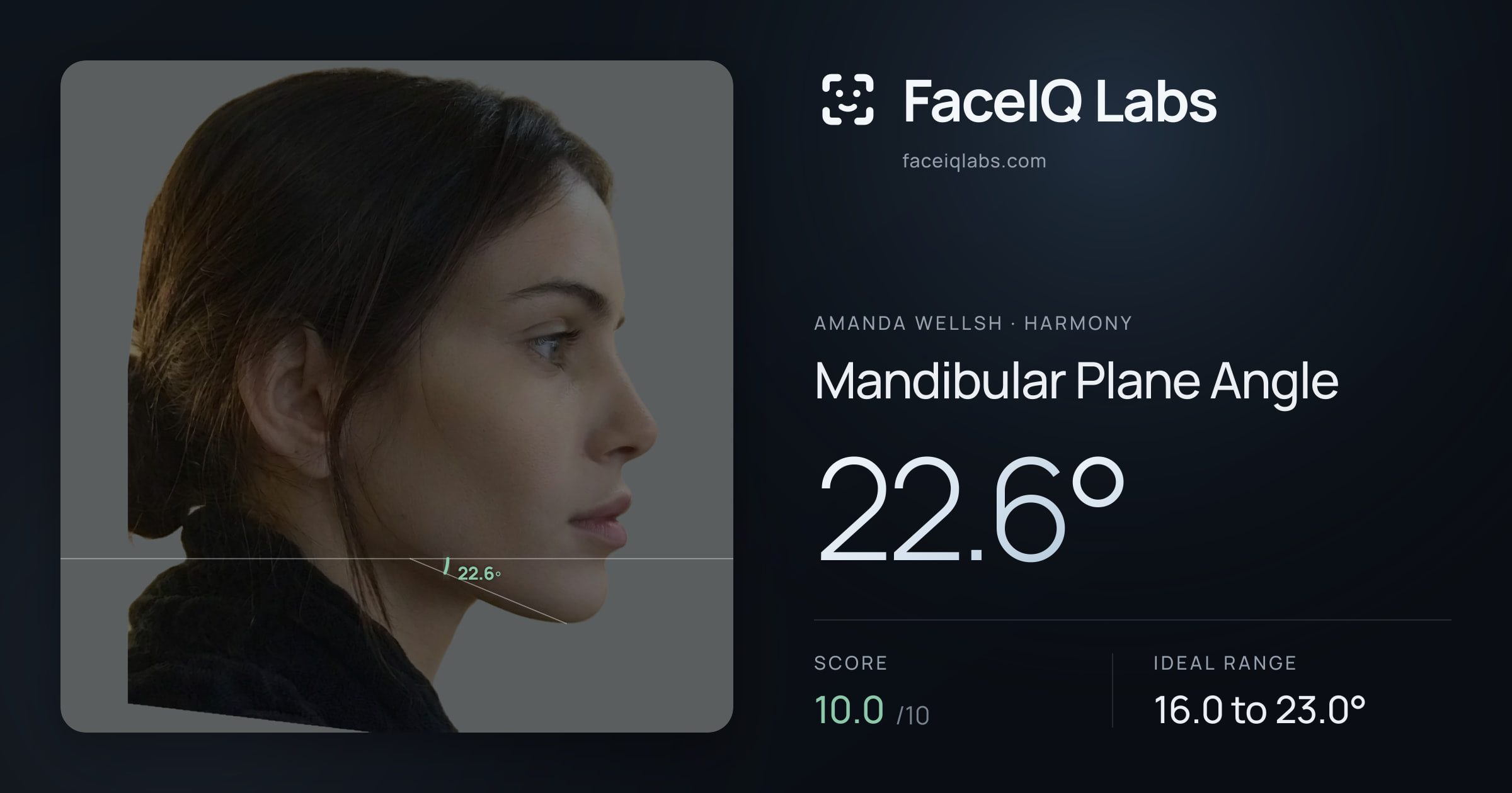 Amanda Wellsh Mandibular Plane Angle: 22.6°, drawn on the photo
