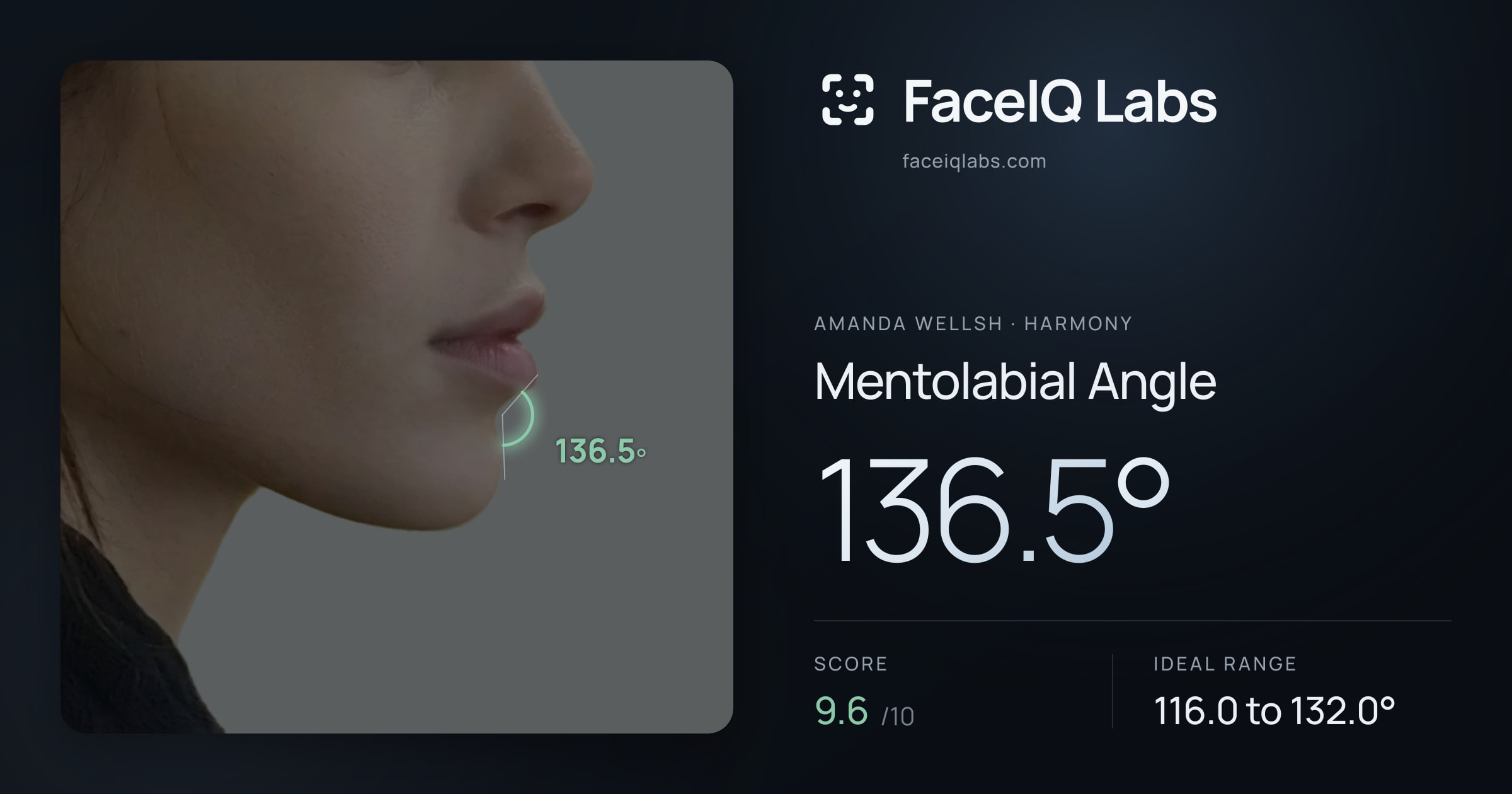 Amanda Wellsh Mentolabial Angle: 136.5°, drawn on the photo