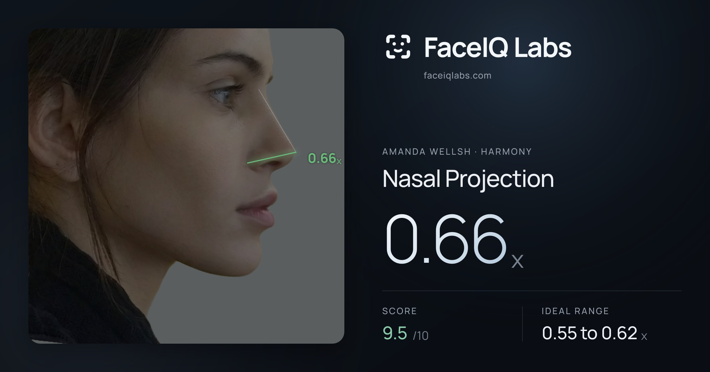 Amanda Wellsh Nasal Projection: 0.66x, drawn on the photo