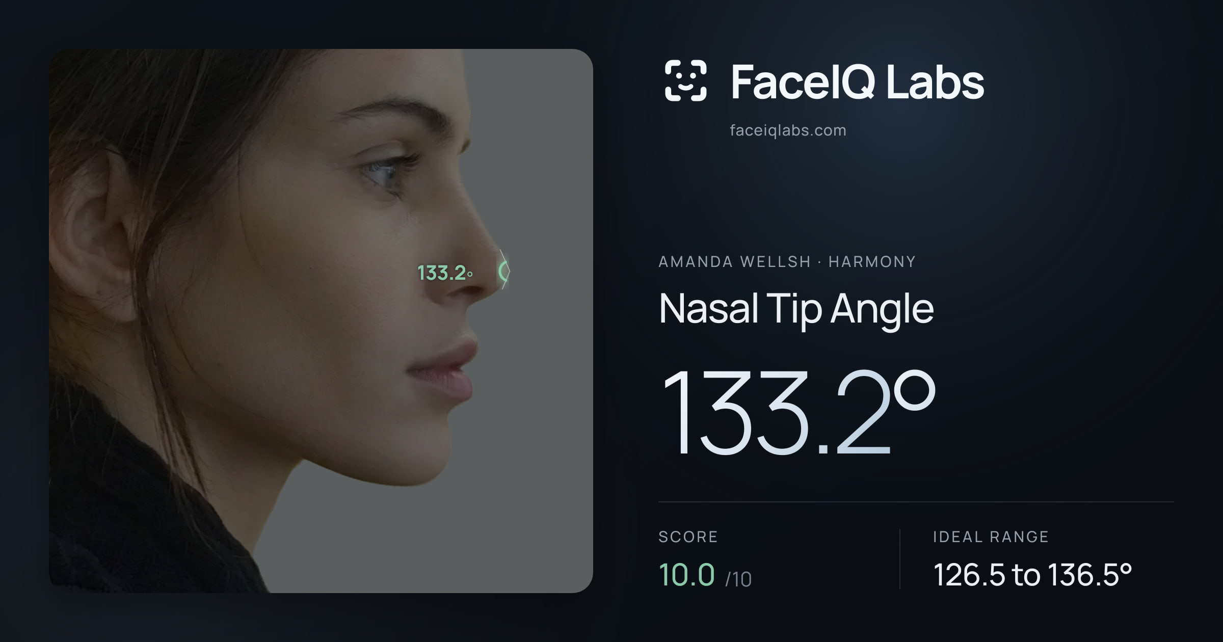 Amanda Wellsh Nasal Tip Angle: 133.2°, drawn on the photo