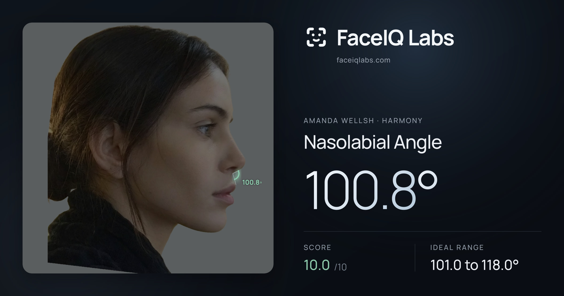 Amanda Wellsh Nasolabial Angle: 100.8°, drawn on the photo