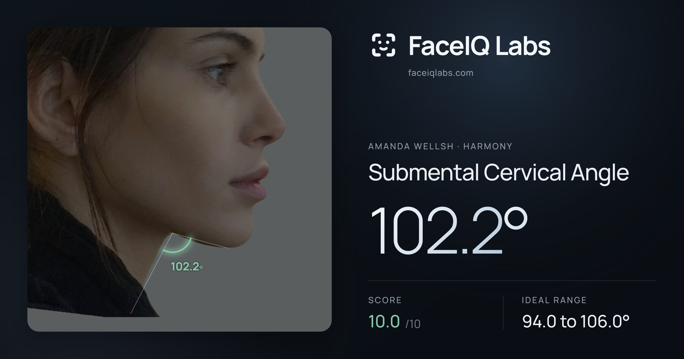 Amanda Wellsh Submental Cervical Angle: 102.2°, drawn on the photo