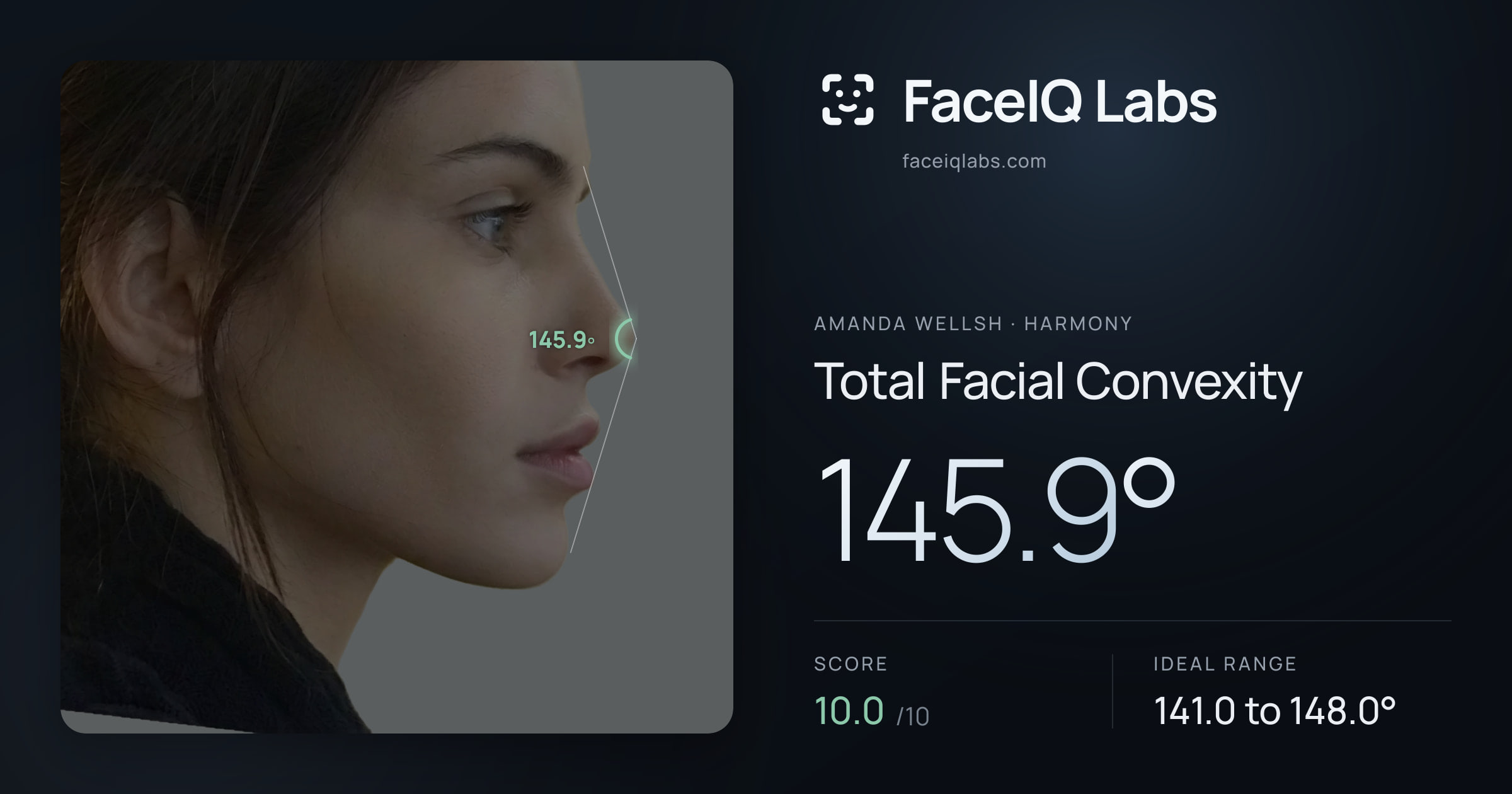 Amanda Wellsh Total Facial Convexity: 145.9°, drawn on the photo
