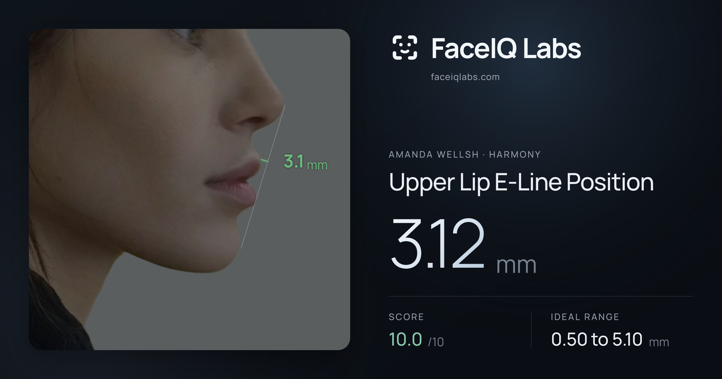 Amanda Wellsh Upper Lip E-Line Position: 3.12mm, drawn on the photo