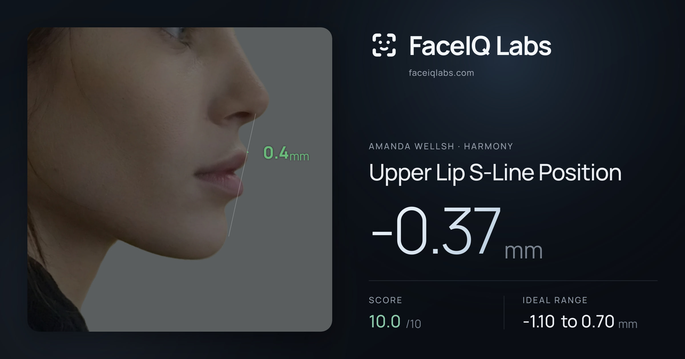 Amanda Wellsh Upper Lip S-Line Position: -0.37mm, drawn on the photo