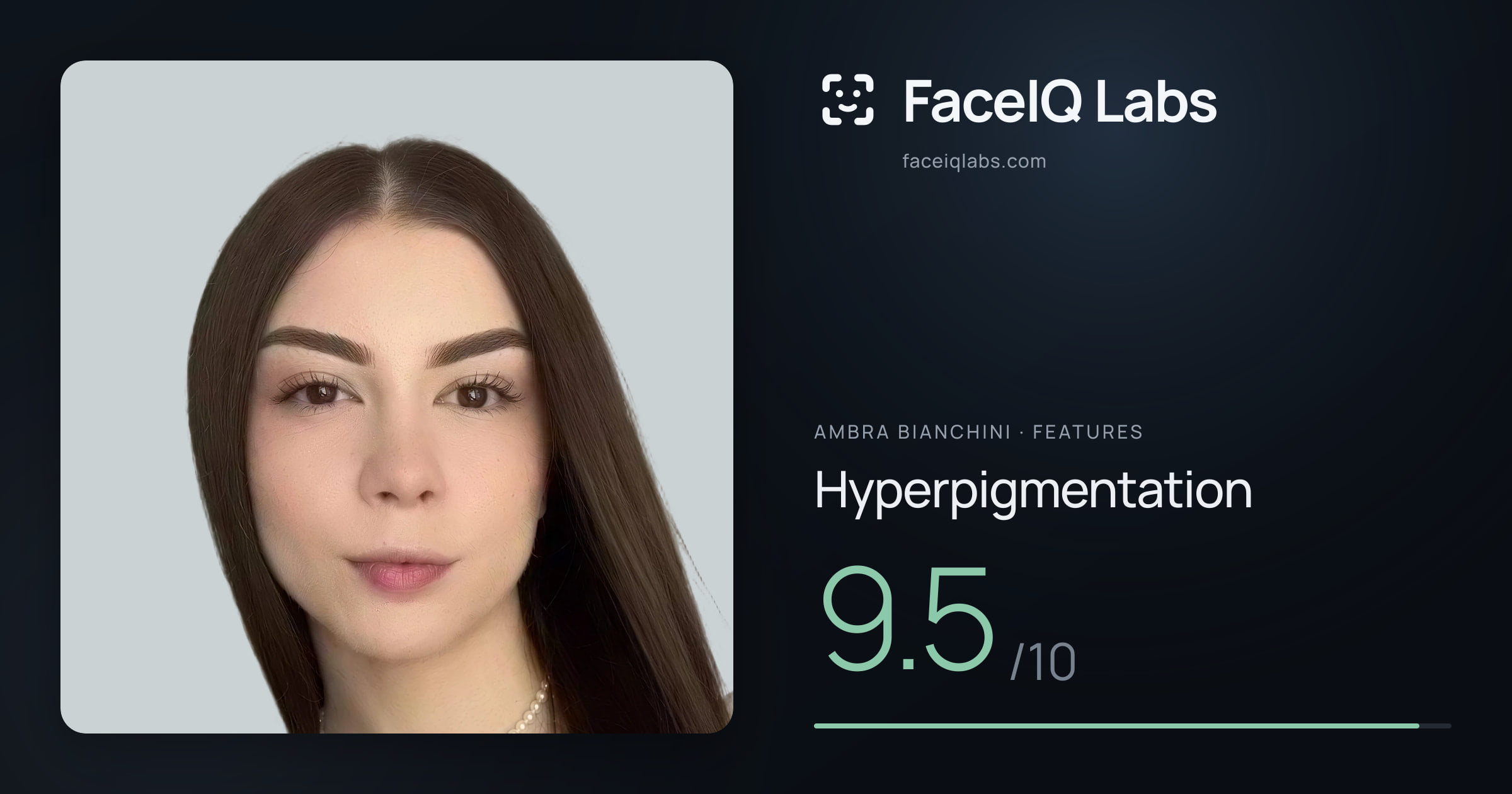 Ambra Bianchini Hyperpigmentation: 9.5/10, drawn on the photo