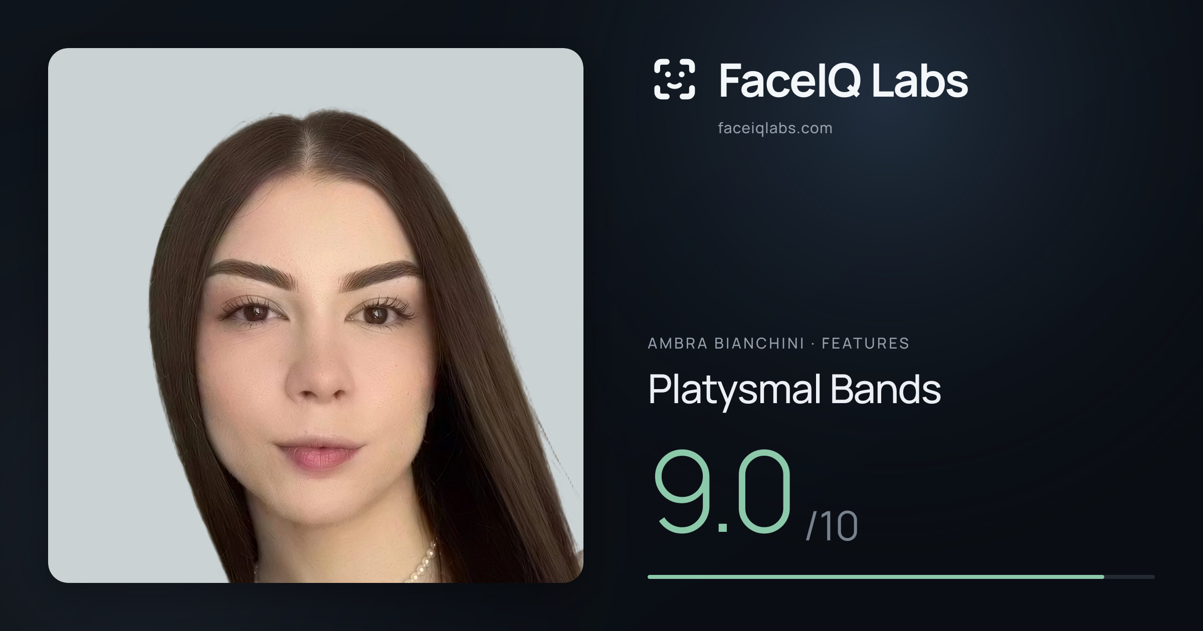 Ambra Bianchini Platysmal Bands: 9.0/10, drawn on the photo