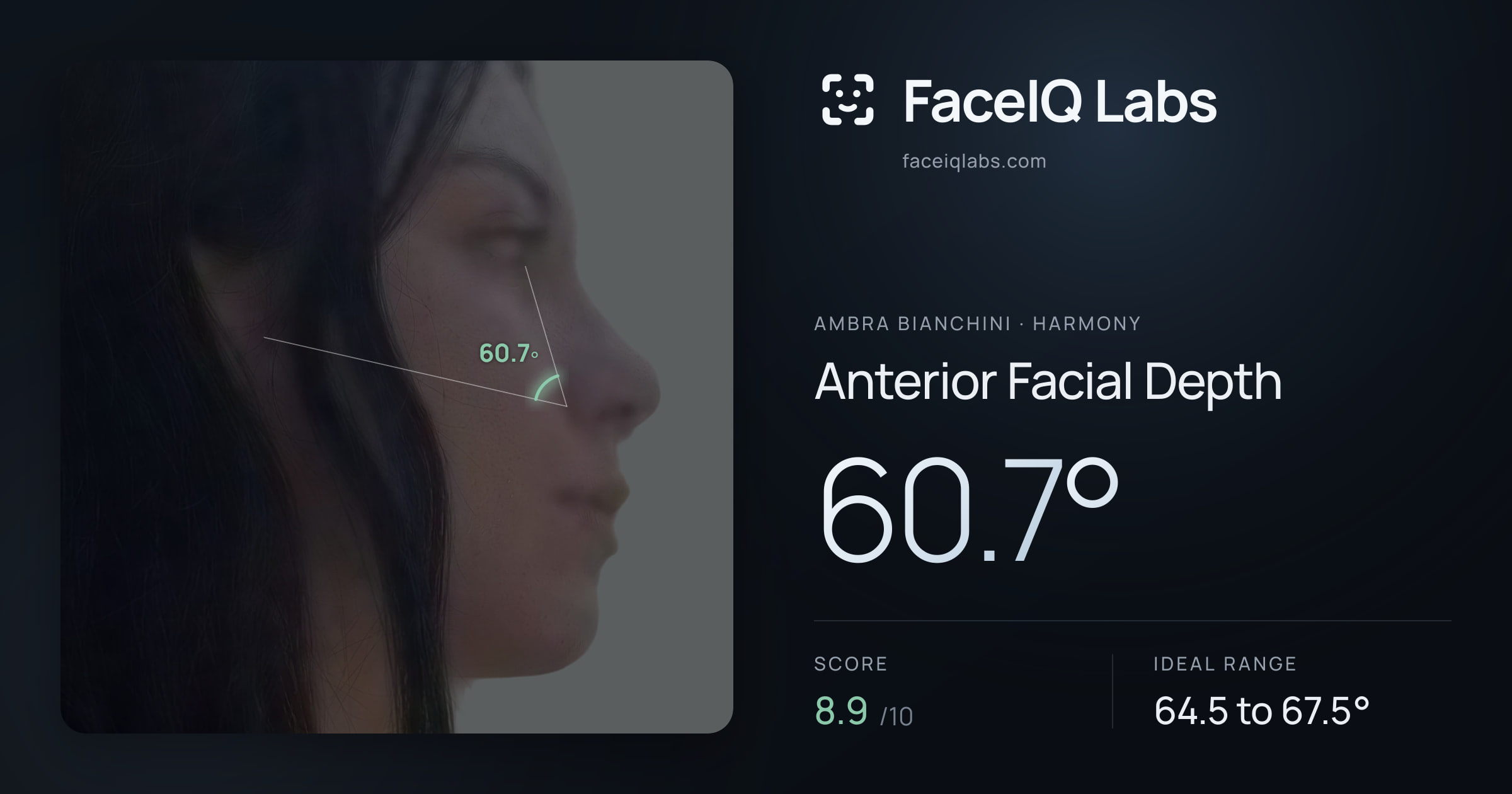 Ambra Bianchini Anterior Facial Depth: 60.7°, drawn on the photo
