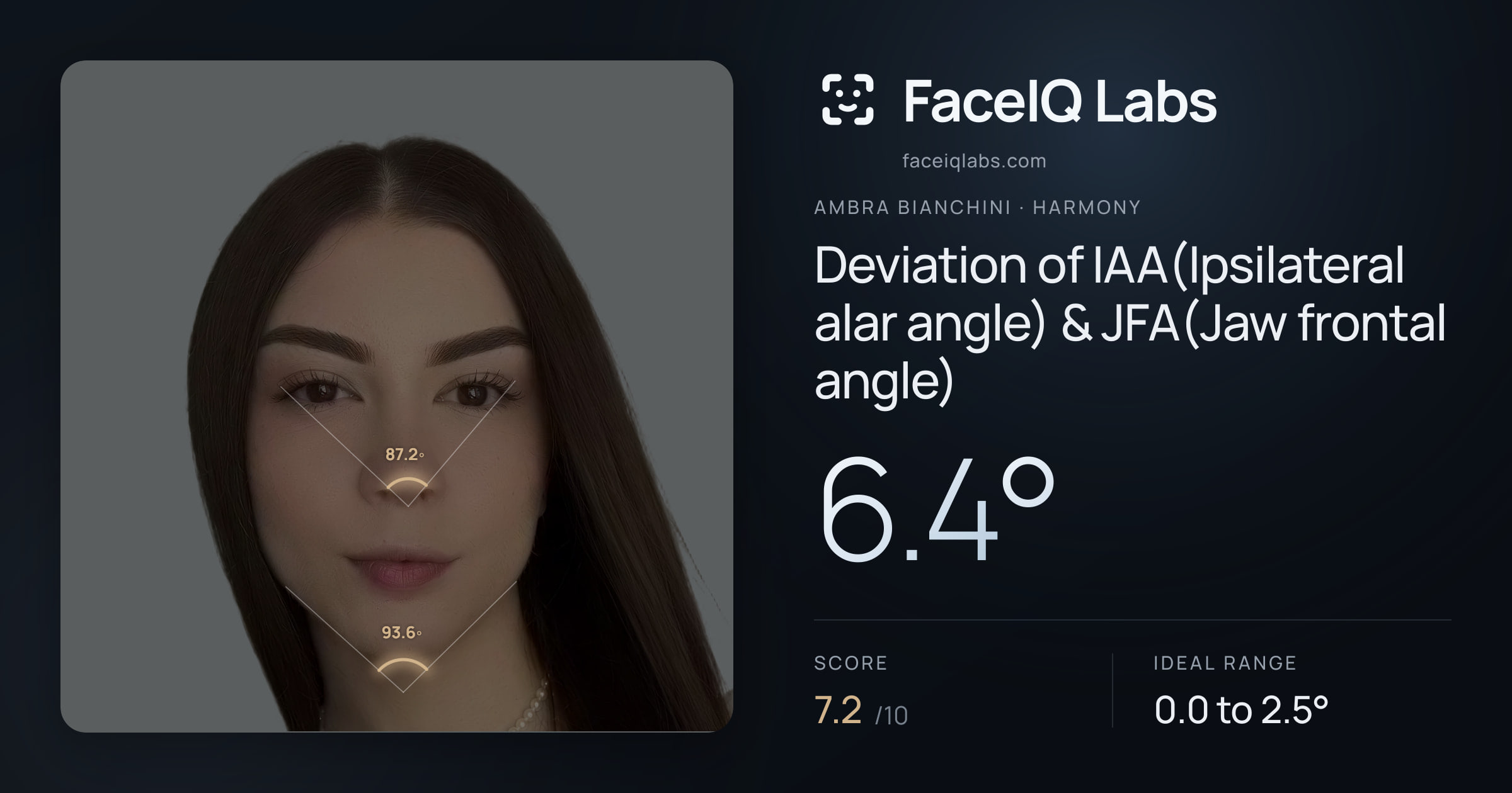 Ambra Bianchini Deviation of IAA(Ipsilateral alar angle) & JFA(Jaw frontal angle): 6.4°, drawn on the photo