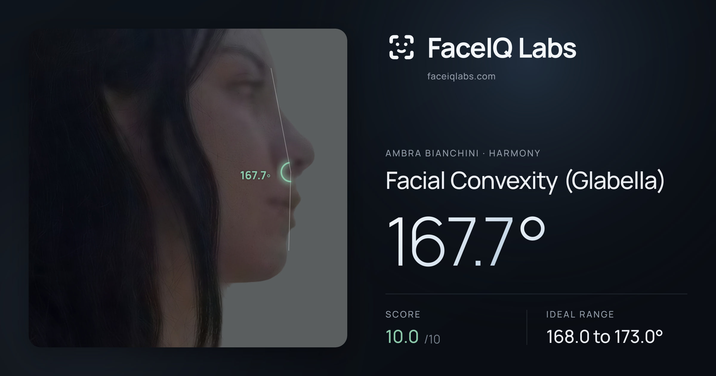 Ambra Bianchini Facial Convexity (Glabella): 167.7°, drawn on the photo