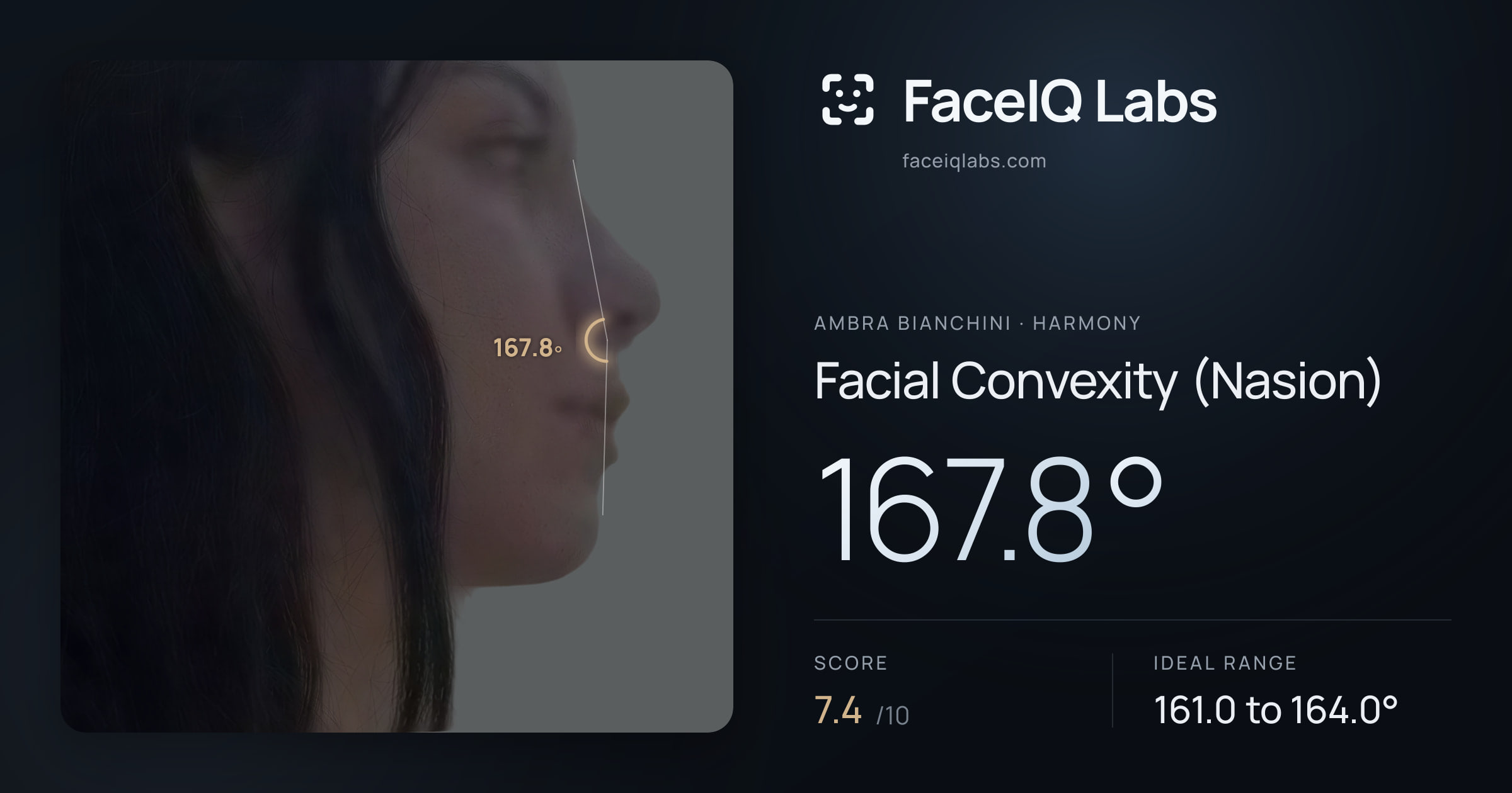 Ambra Bianchini Facial Convexity (Nasion): 167.8°, drawn on the photo