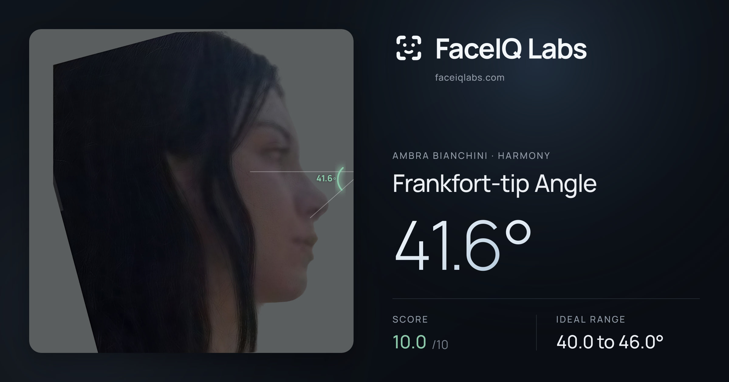 Ambra Bianchini Frankfort-tip Angle: 41.6°, drawn on the photo