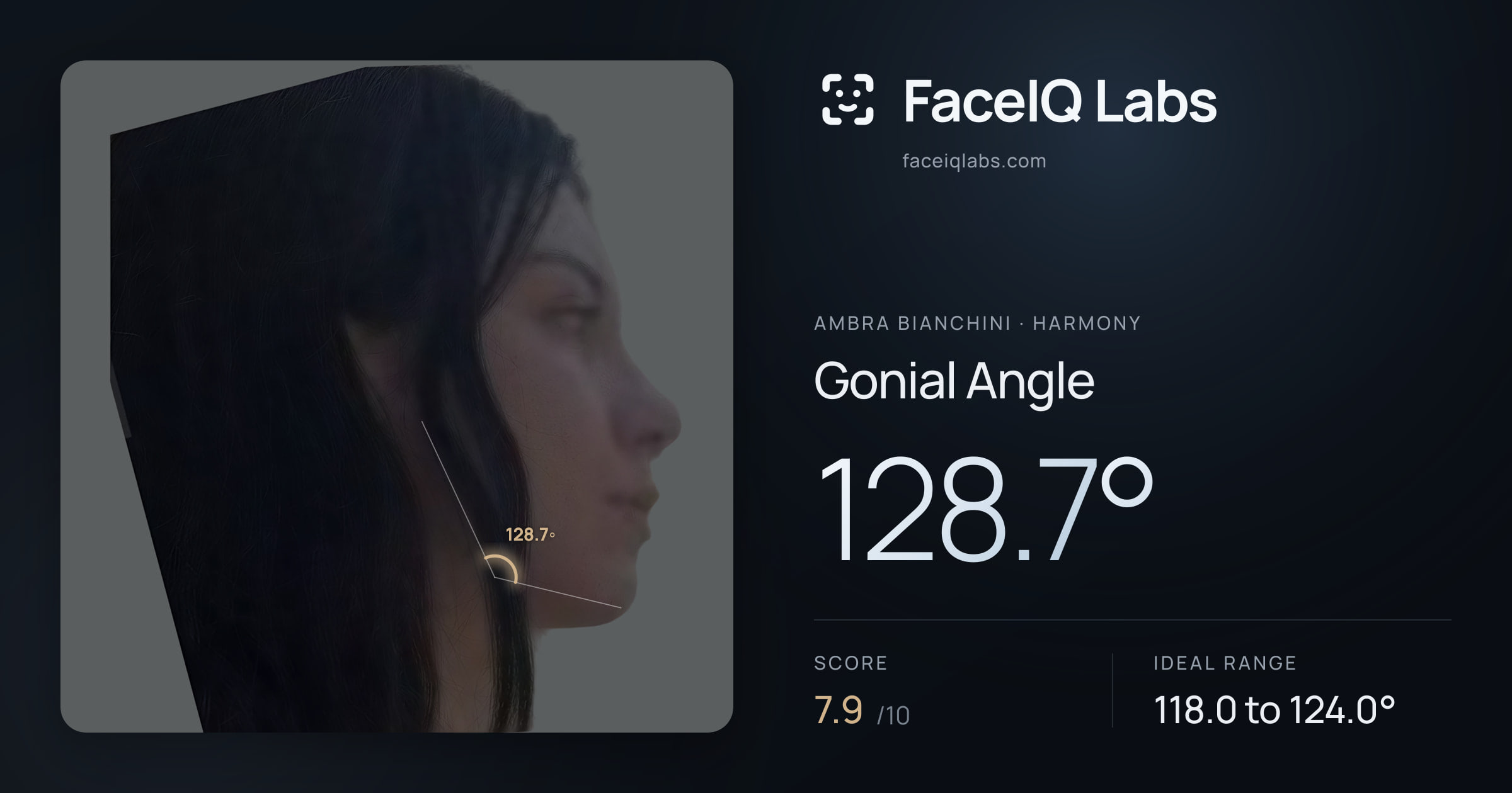Ambra Bianchini Gonial Angle: 128.7°, drawn on the photo
