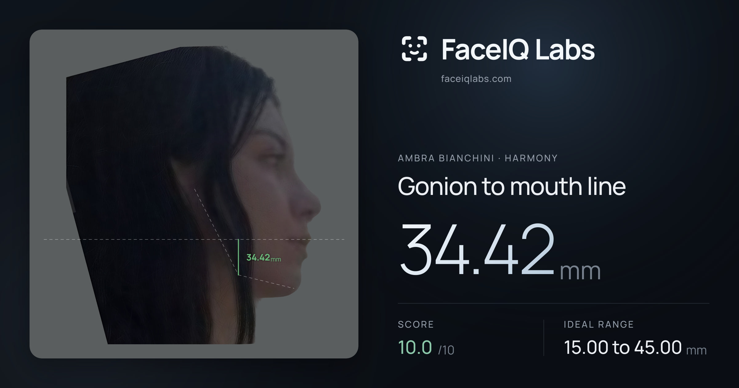 Ambra Bianchini Gonion to mouth line: 34.42mm, drawn on the photo