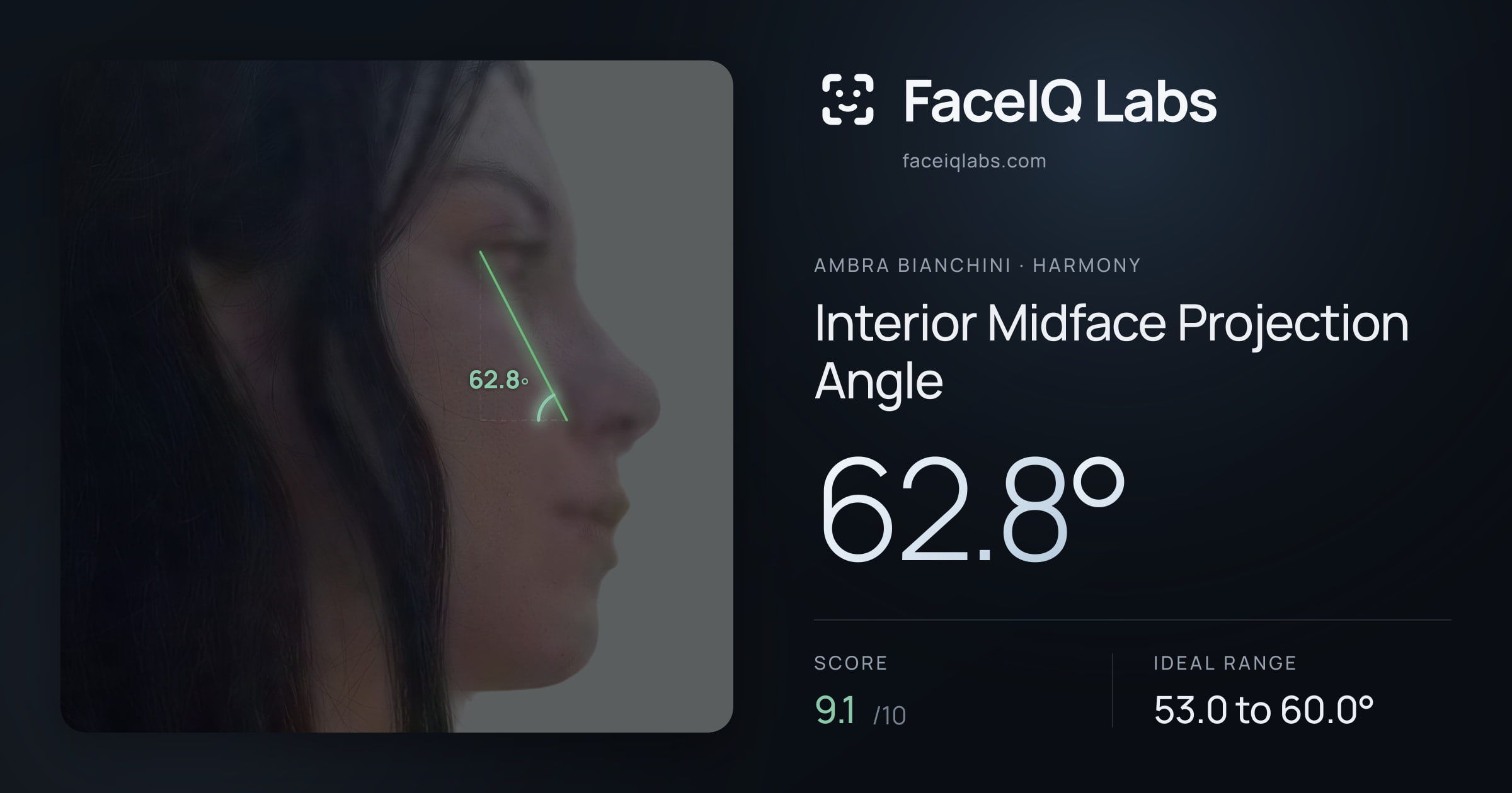 Ambra Bianchini Interior Midface Projection Angle: 62.8°, drawn on the photo