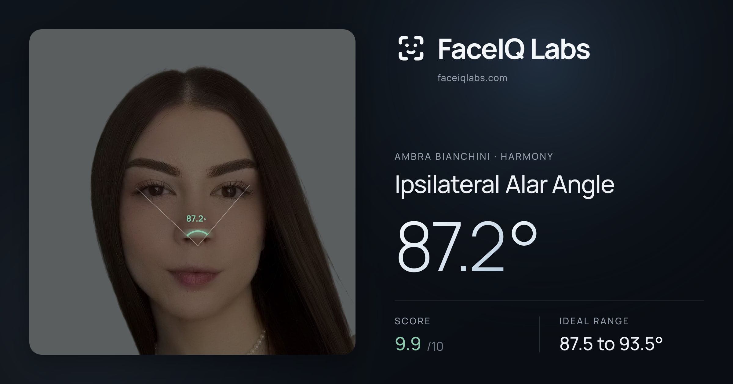 Ambra Bianchini Ipsilateral Alar Angle: 87.2°, drawn on the photo