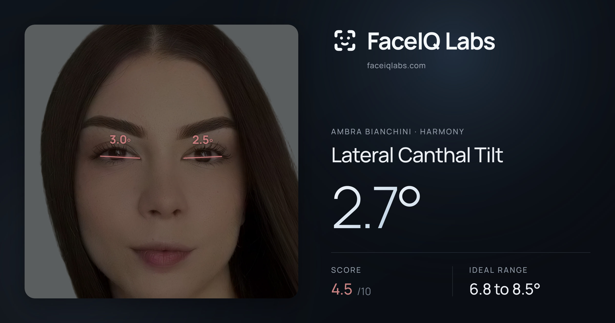 Ambra Bianchini Lateral Canthal Tilt: 2.7°, drawn on the photo