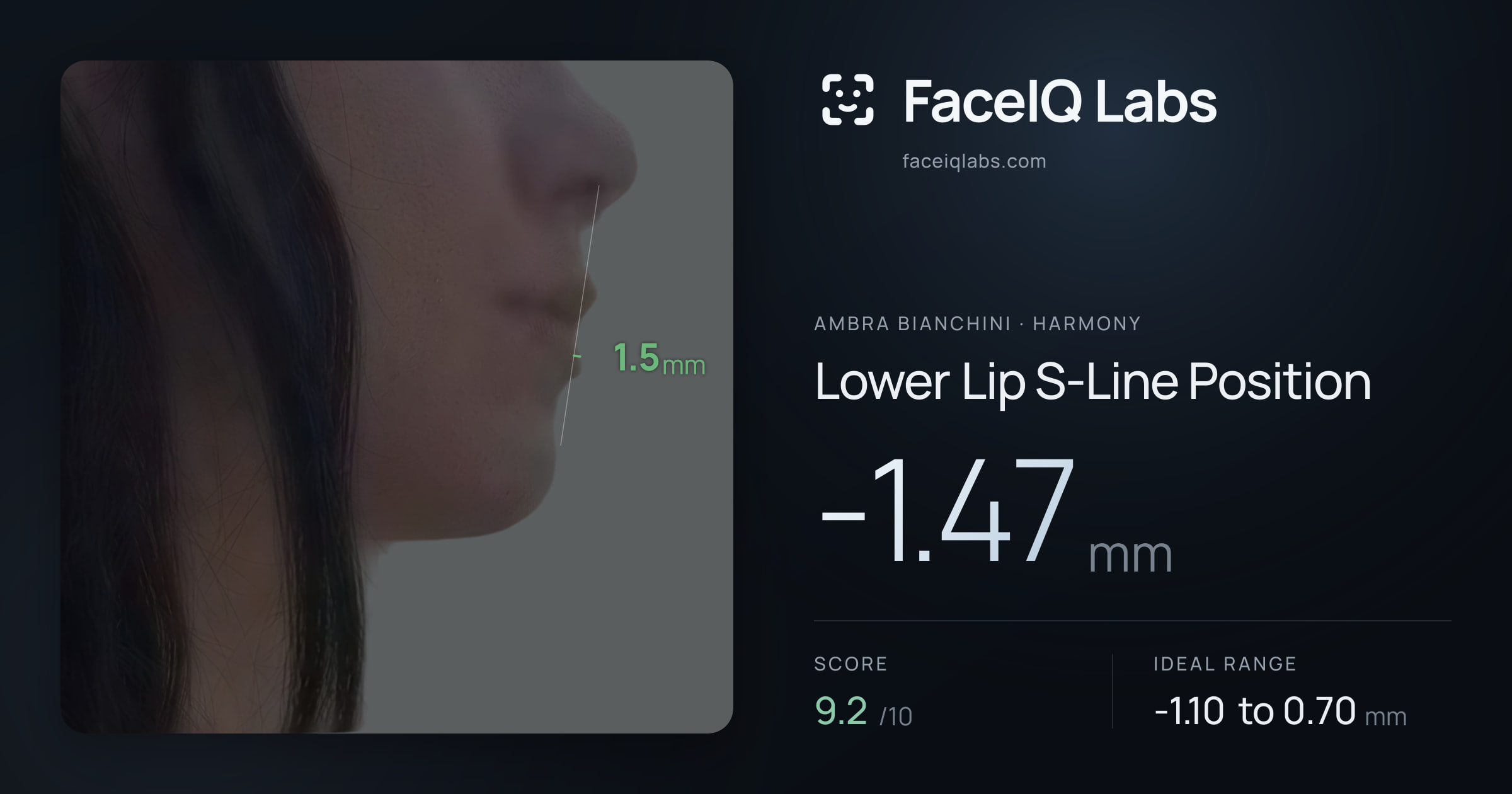 Ambra Bianchini Lower Lip S-Line Position: -1.47mm, drawn on the photo