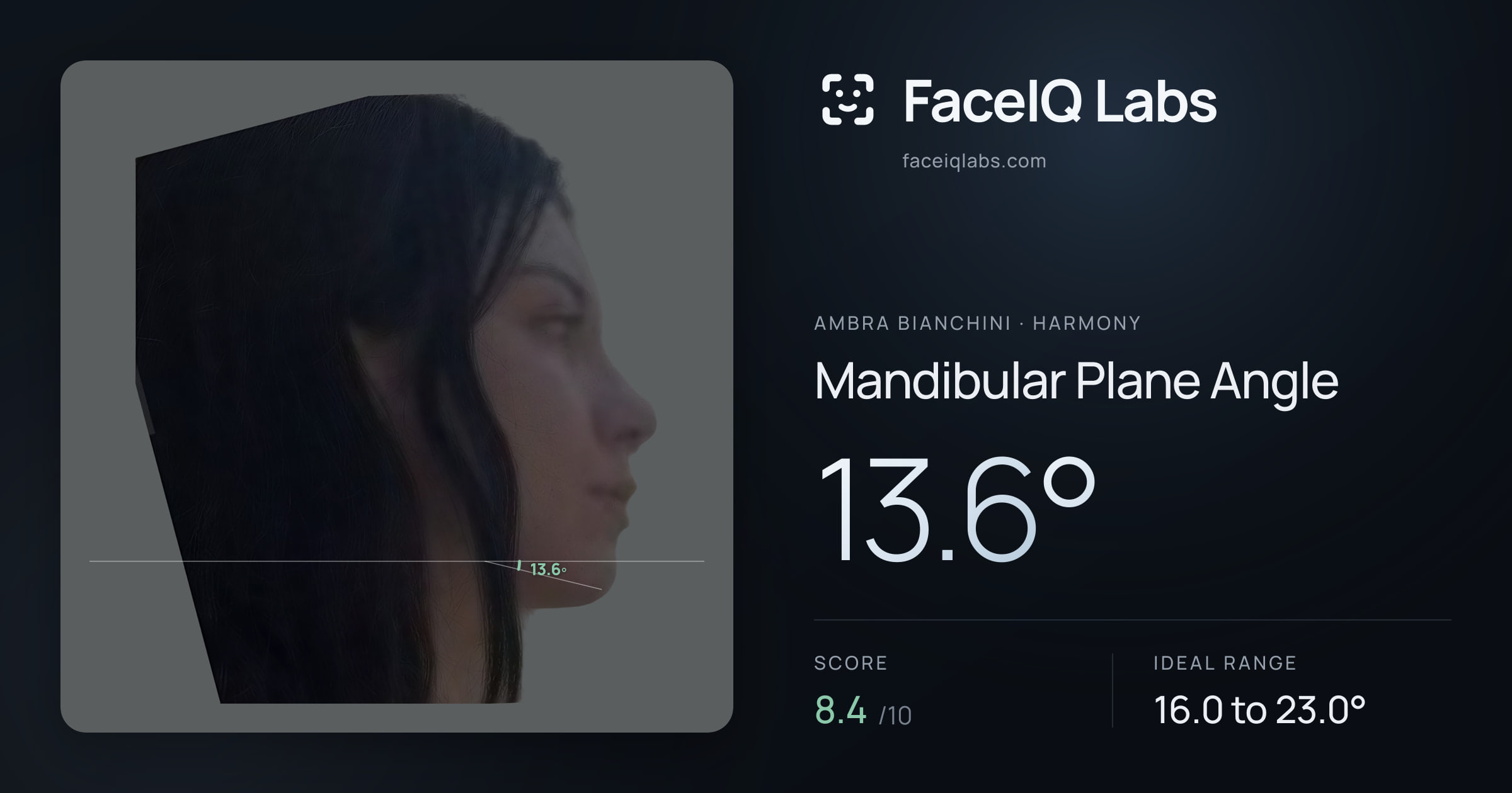 Ambra Bianchini Mandibular Plane Angle: 13.6°, drawn on the photo