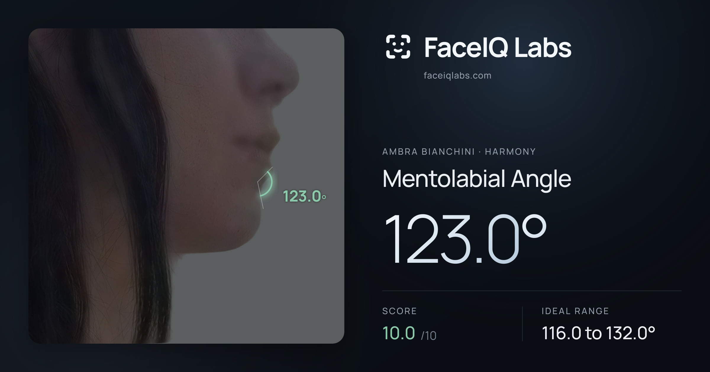 Ambra Bianchini Mentolabial Angle: 123.0°, drawn on the photo