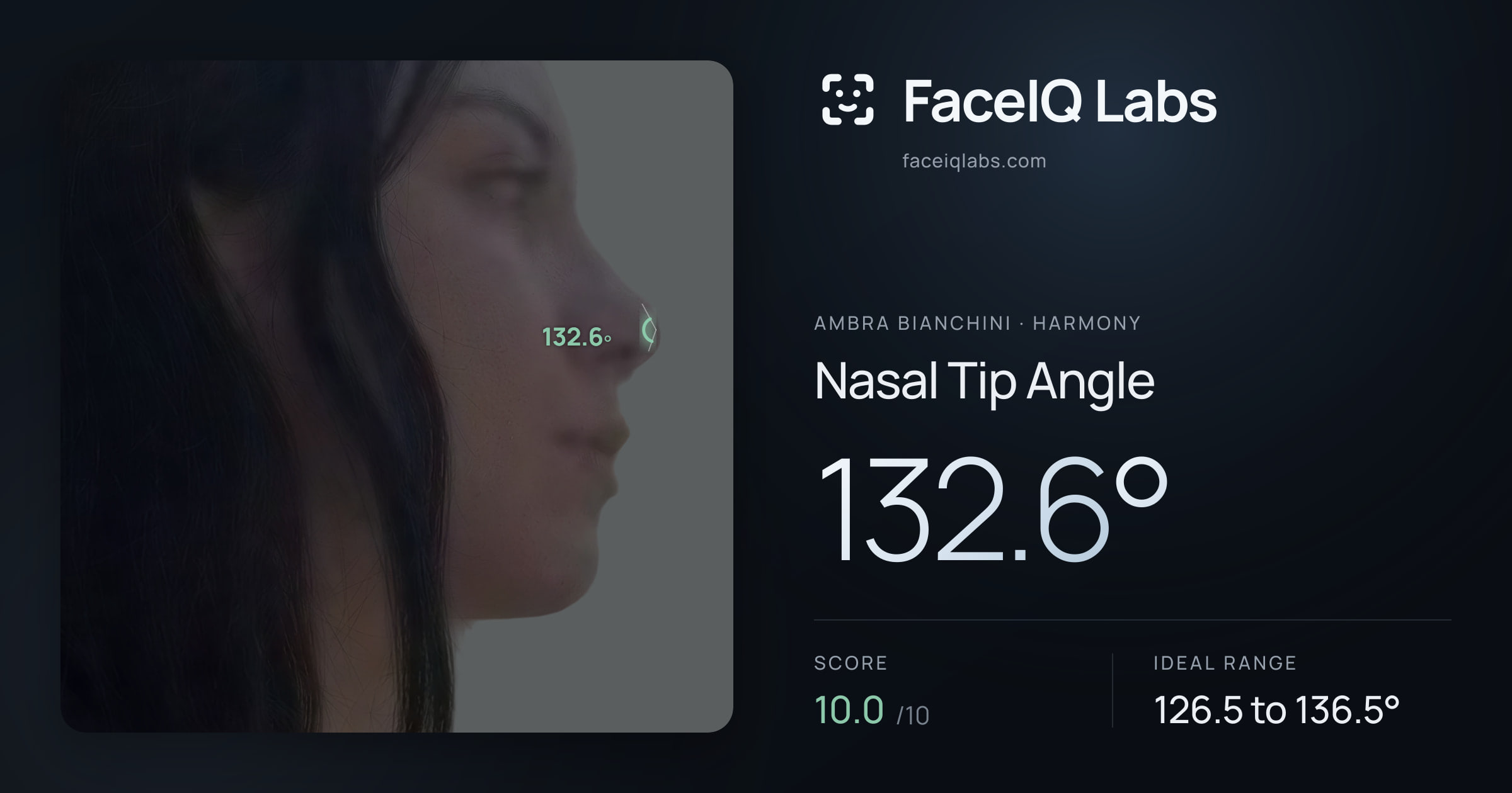 Ambra Bianchini Nasal Tip Angle: 132.6°, drawn on the photo