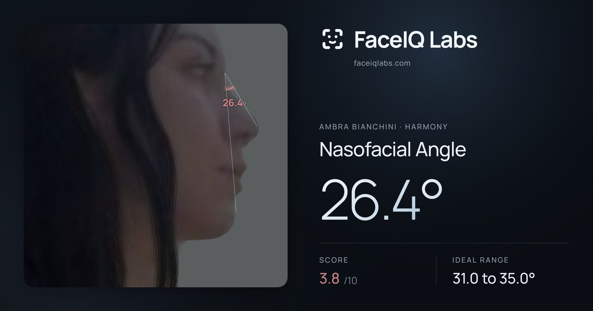 Ambra Bianchini Nasofacial Angle: 26.4°, drawn on the photo