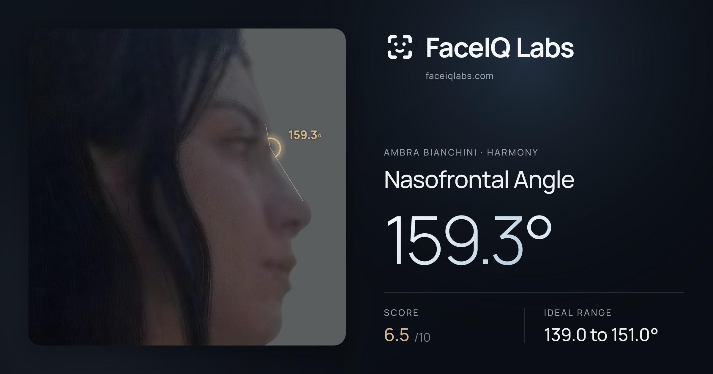 Ambra Bianchini Nasofrontal Angle: 159.3°, drawn on the photo