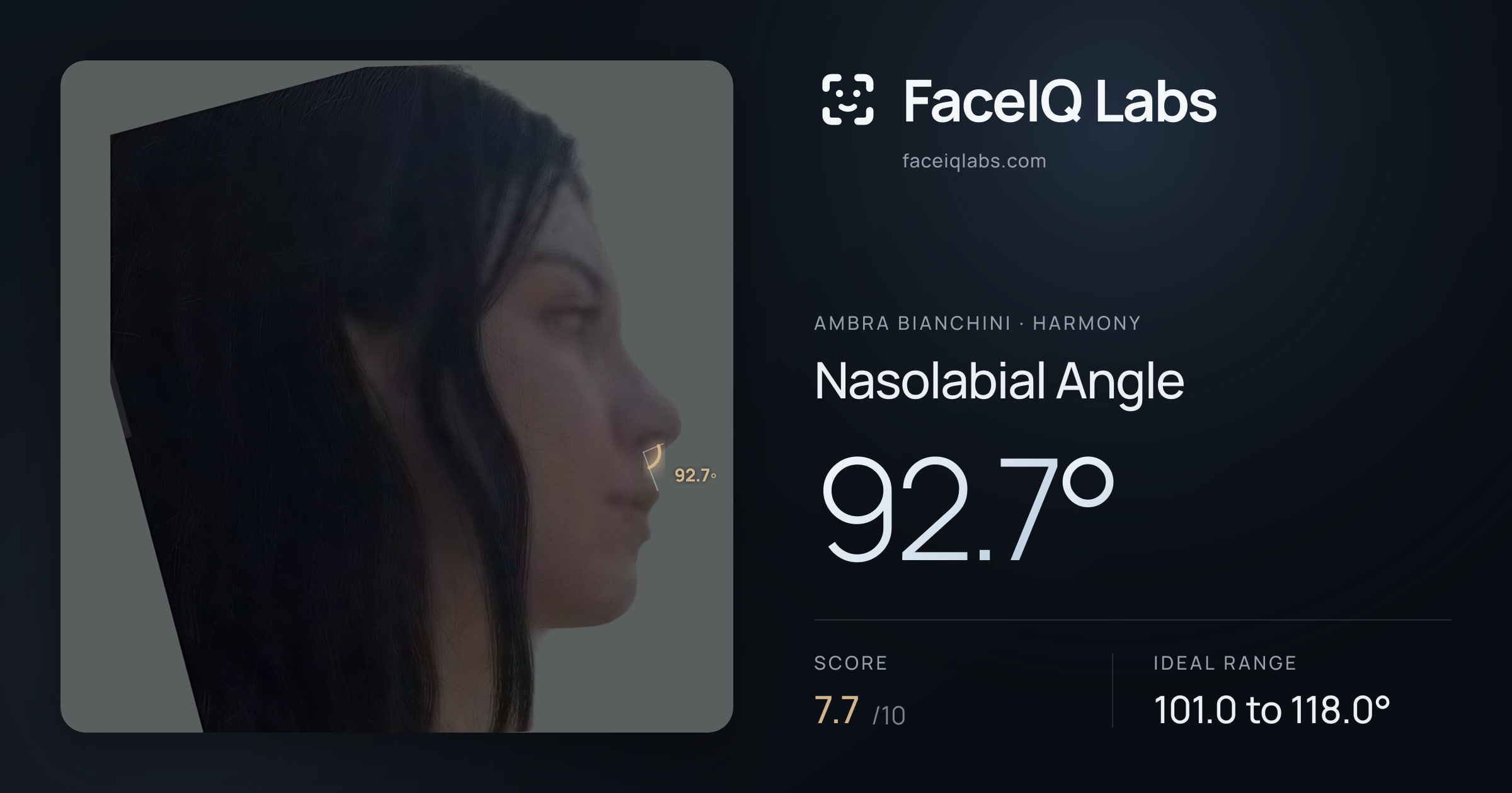 Ambra Bianchini Nasolabial Angle: 92.7°, drawn on the photo