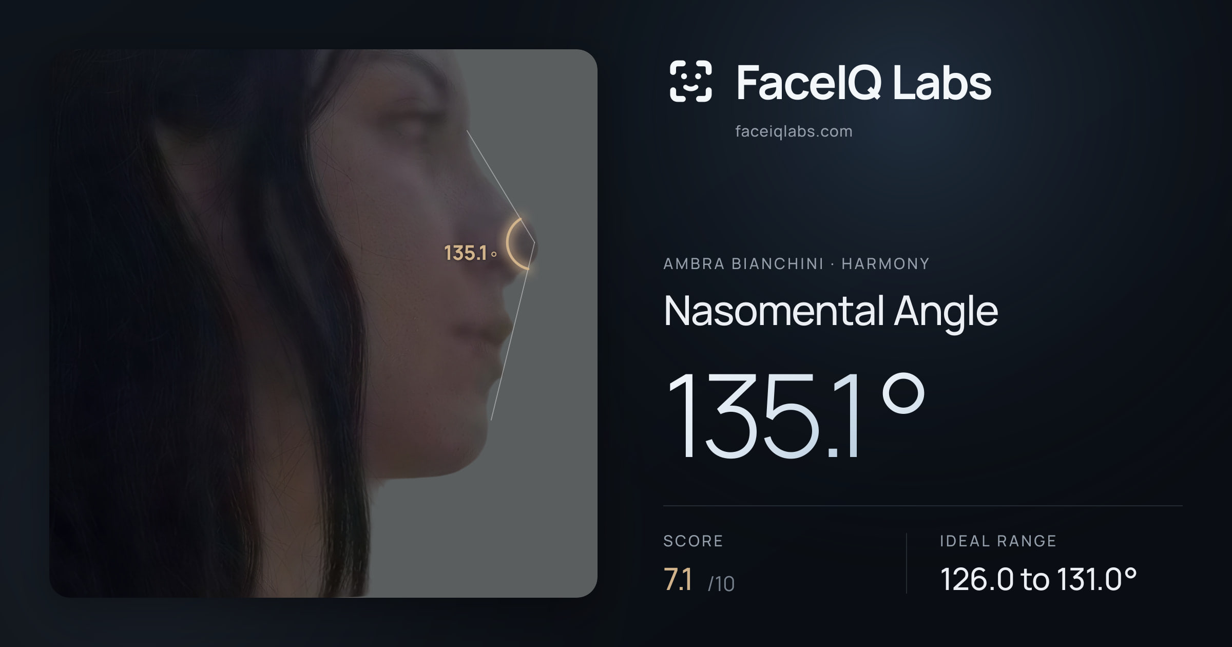 Ambra Bianchini Nasomental Angle: 135.1°, drawn on the photo