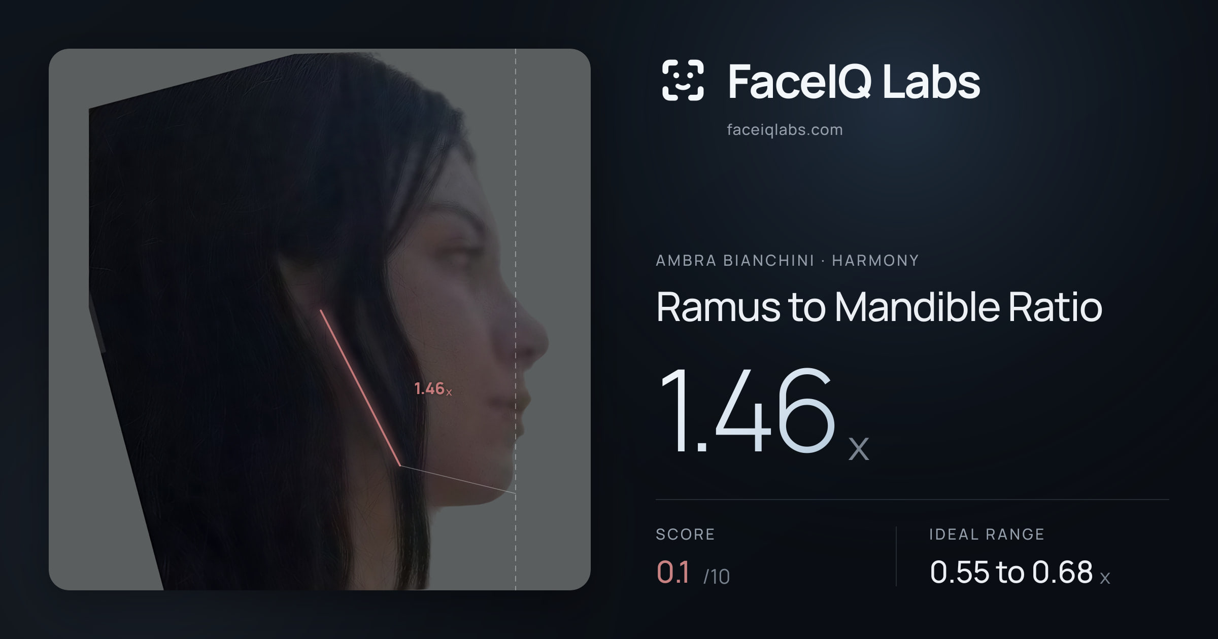 Ambra Bianchini Ramus to Mandible Ratio: 1.46x, drawn on the photo