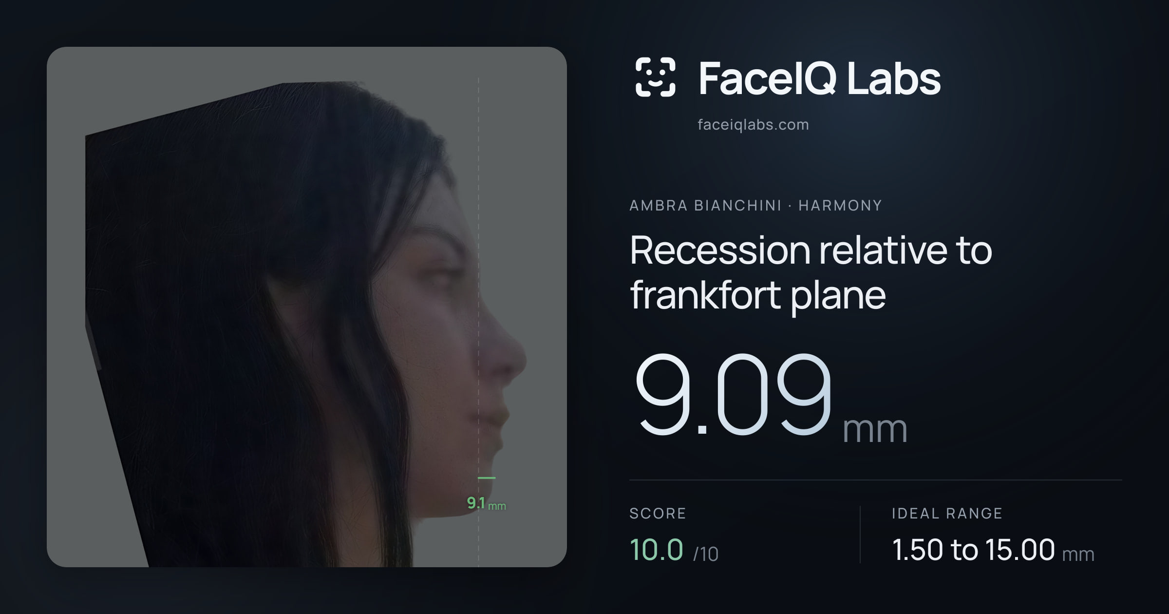 Ambra Bianchini Recession relative to frankfort plane: 9.09mm, drawn on the photo