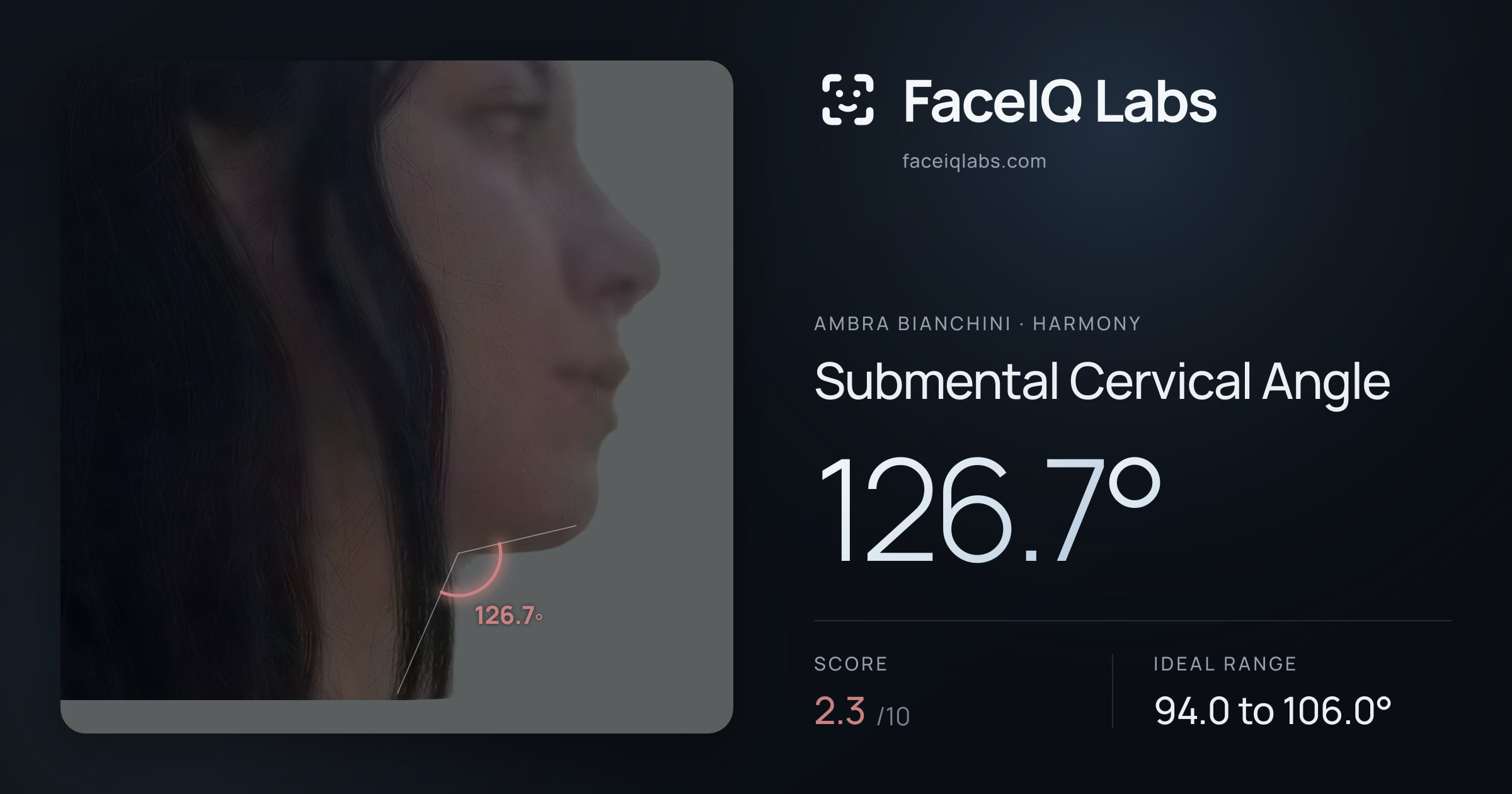 Ambra Bianchini Submental Cervical Angle: 126.7°, drawn on the photo