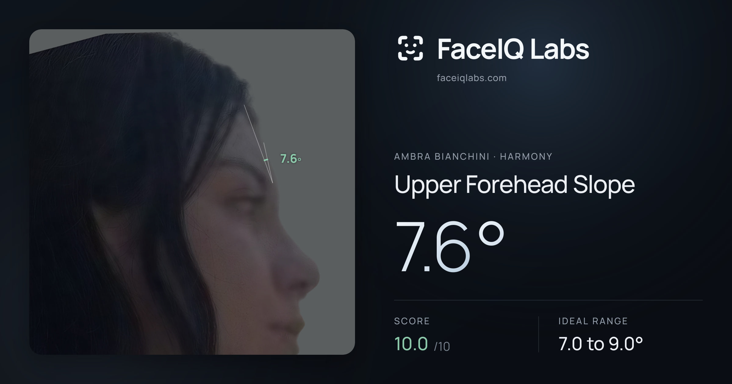 Ambra Bianchini Upper Forehead Slope: 7.6°, drawn on the photo
