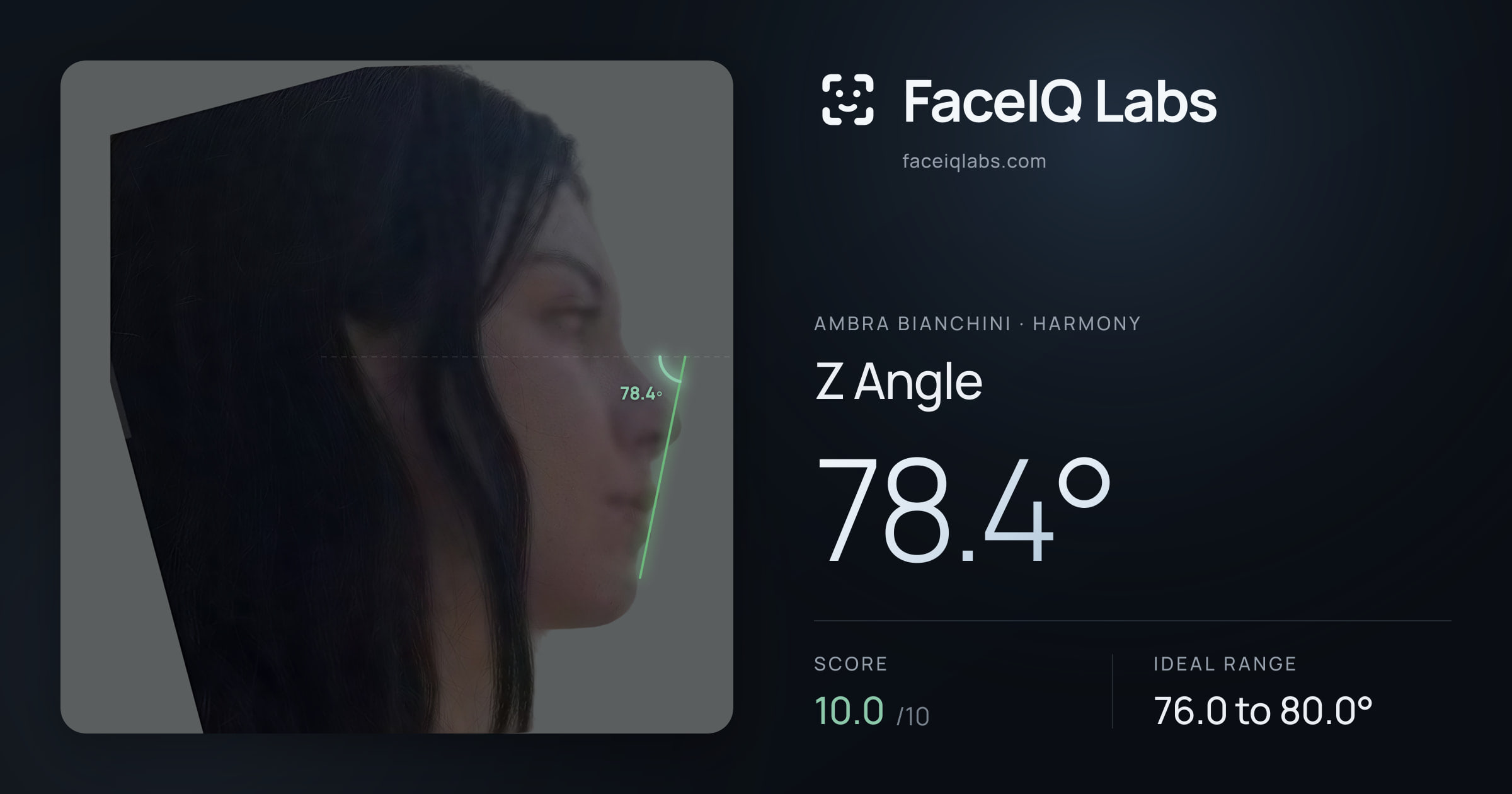Ambra Bianchini Z Angle: 78.4°, drawn on the photo