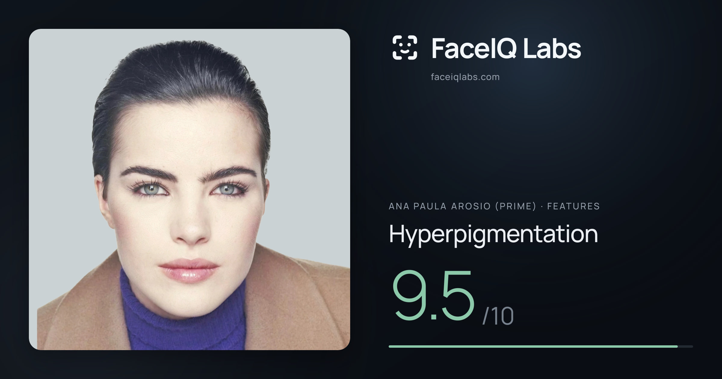 Ana paula arosio (prime) Hyperpigmentation: 9.5/10, drawn on the photo