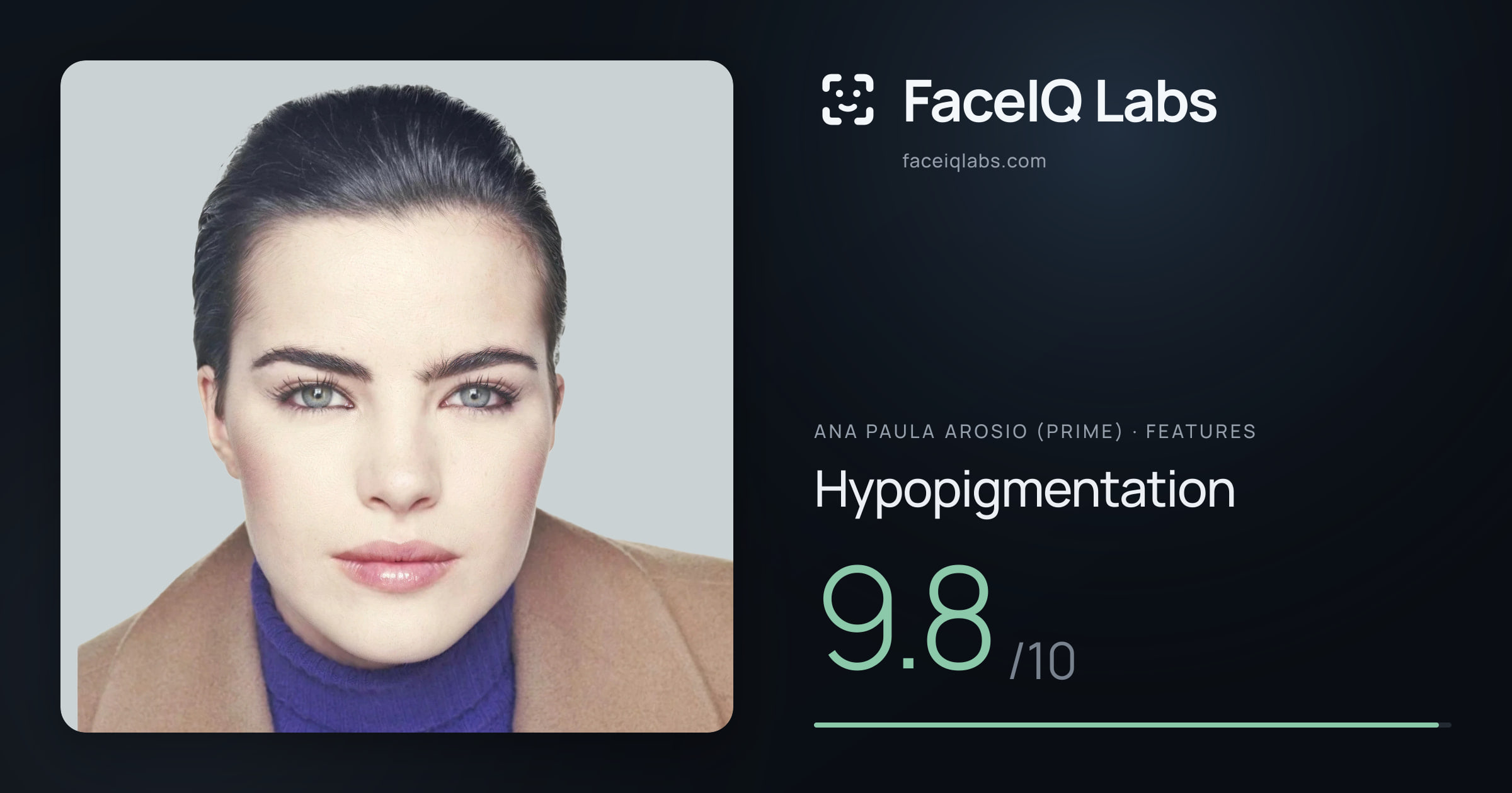 Ana paula arosio (prime) Hypopigmentation: 9.8/10, drawn on the photo