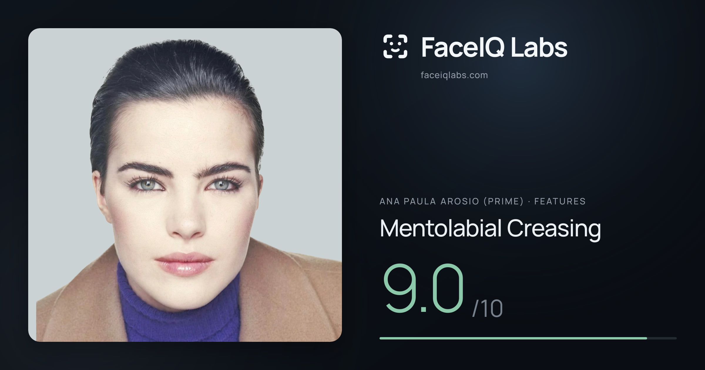Ana paula arosio (prime) Mentolabial Creasing: 9.0/10, drawn on the photo