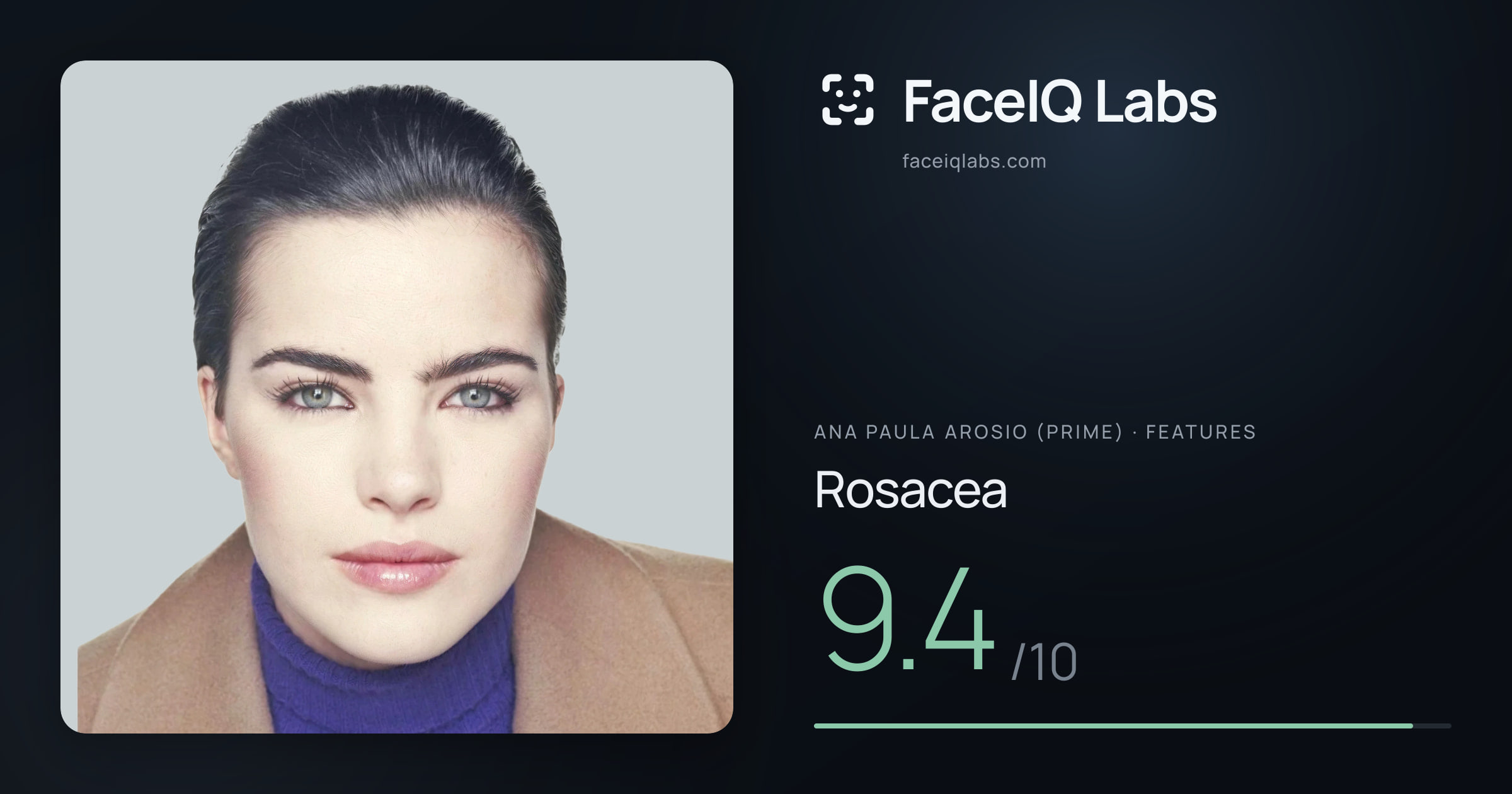 Ana paula arosio (prime) Rosacea: 9.4/10, drawn on the photo
