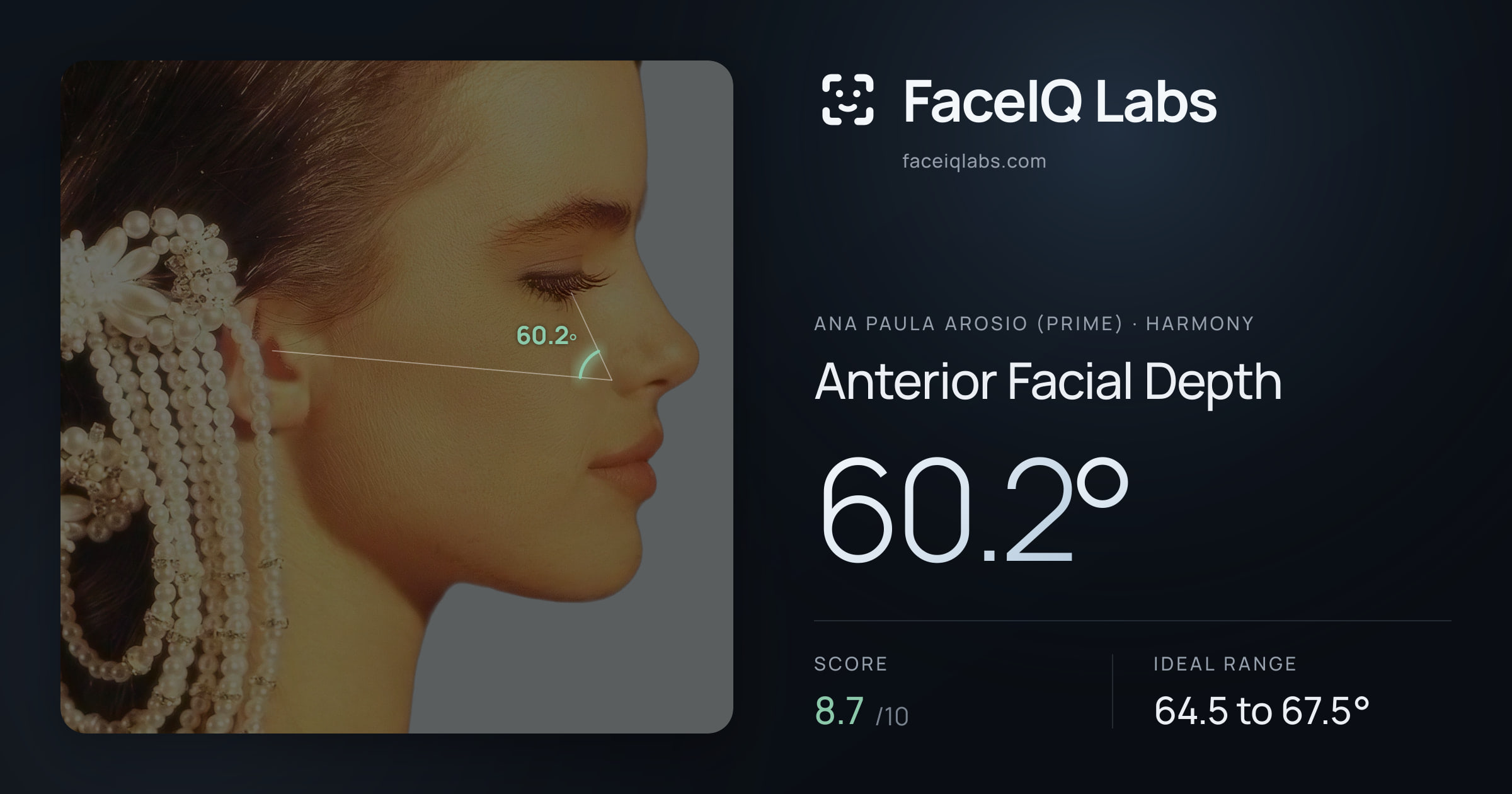 Ana paula arosio (prime) Anterior Facial Depth: 60.2°, drawn on the photo