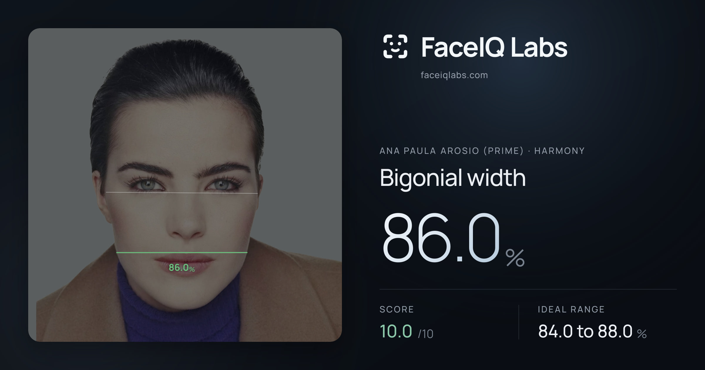 Ana paula arosio (prime) Bigonial width: 86.0%, drawn on the photo