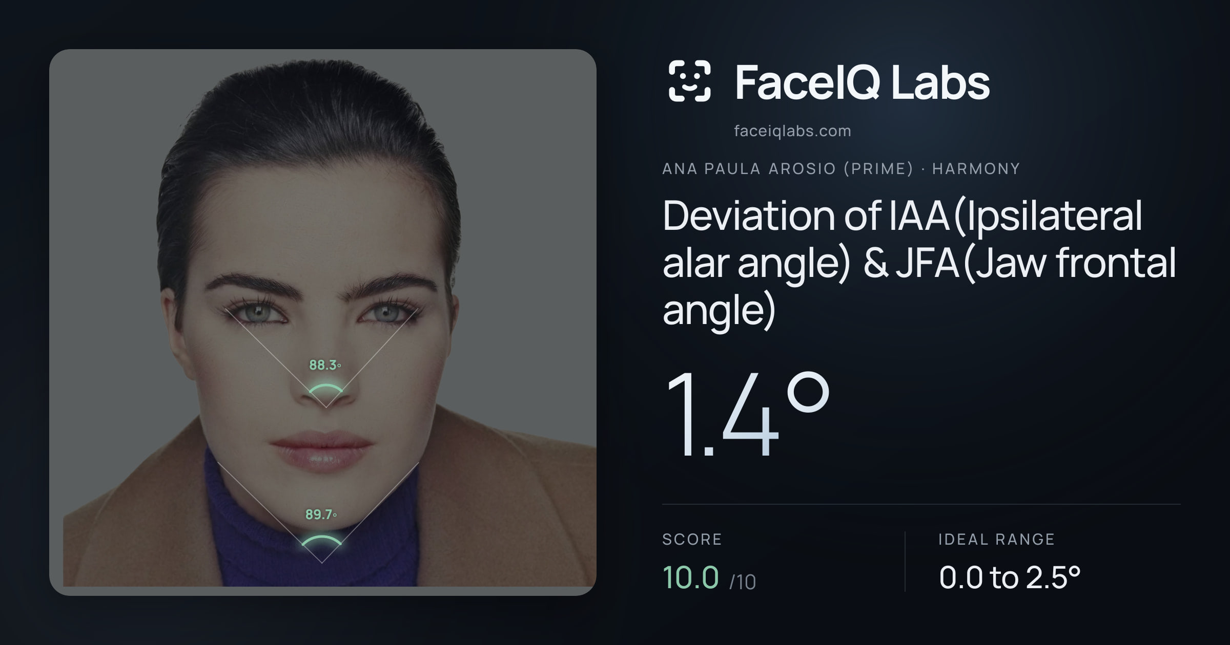 Ana paula arosio (prime) Deviation of IAA(Ipsilateral alar angle) & JFA(Jaw frontal angle): 1.4°, drawn on the photo
