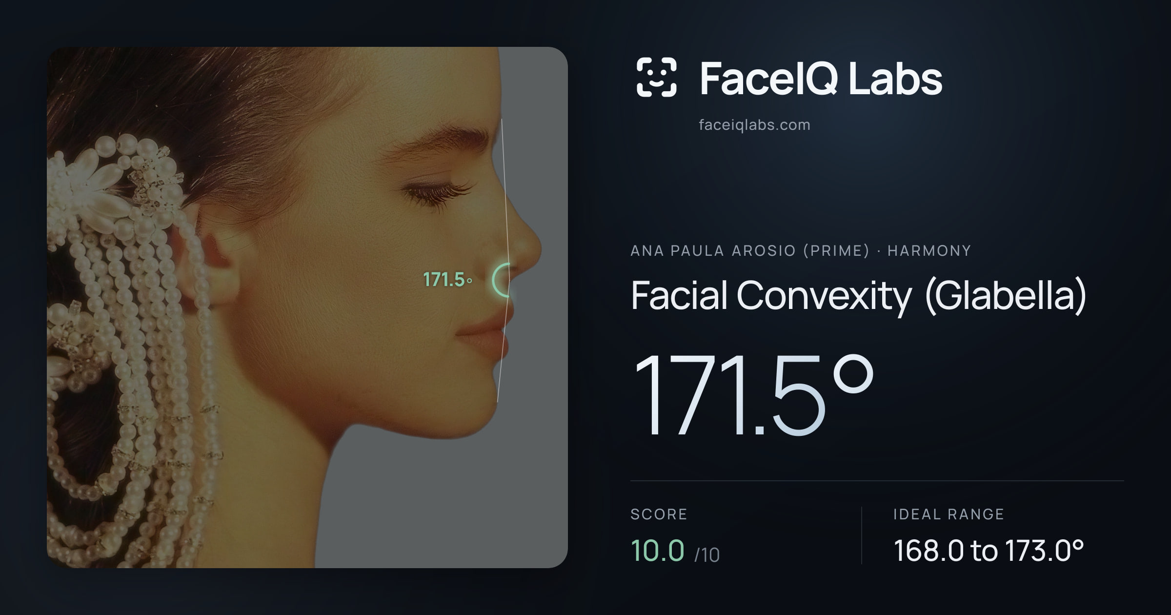 Ana paula arosio (prime) Facial Convexity (Glabella): 171.5°, drawn on the photo