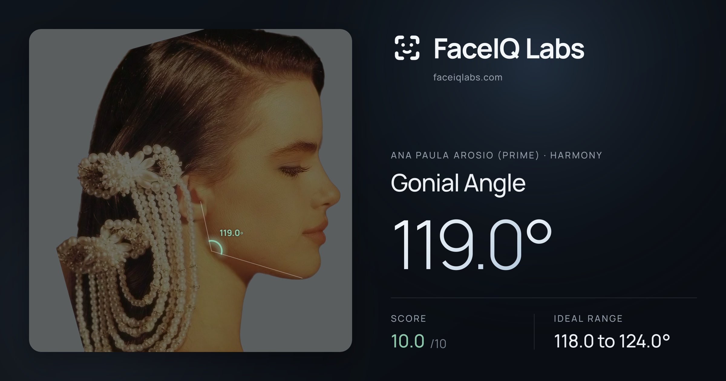 Ana paula arosio (prime) Gonial Angle: 119.0°, drawn on the photo